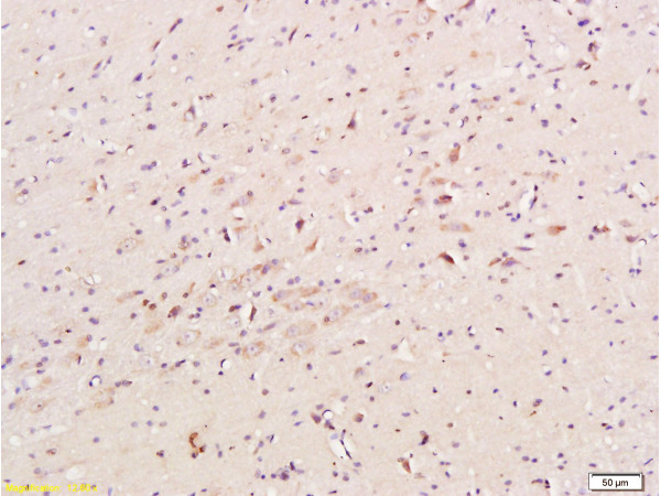 Formalin-fixed and paraffin embedded mouse brain tissue labeled with Anti-CHRNA7 Polyclonal Antibody, Unconjugated (bs-1049R) at 1:200, followed by conjugation to the secondary antibody and DAB staining