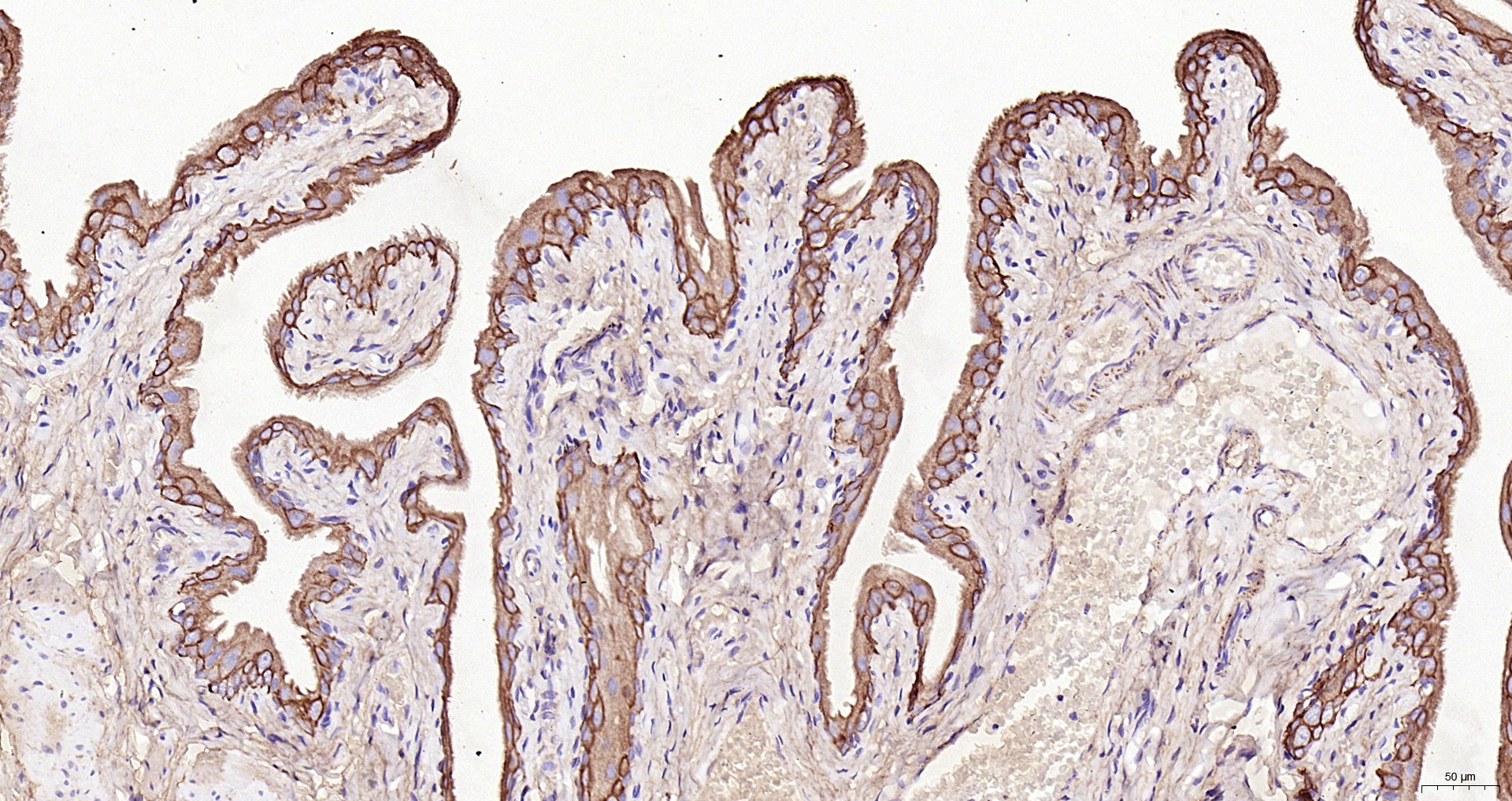 Paraformaldehyde-fixed, paraffin embedded (Rat bladder); Antigen retrieval by boiling in sodium citrate buffer (pH6.0) for 15min; Block endogenous peroxidase by 3% hydrogen peroxide for 20 minutes; Blocking buffer (normal goat serum) at 37°C for 30min; Antibody incubation with (CK7) Polyclonal Antibody, Unconjugated (bs-1610R) at 1:200 overnight at 4°C, followed by operating according to SP Kit(Rabbit) (sp-0023) instructionsand DAB staining.