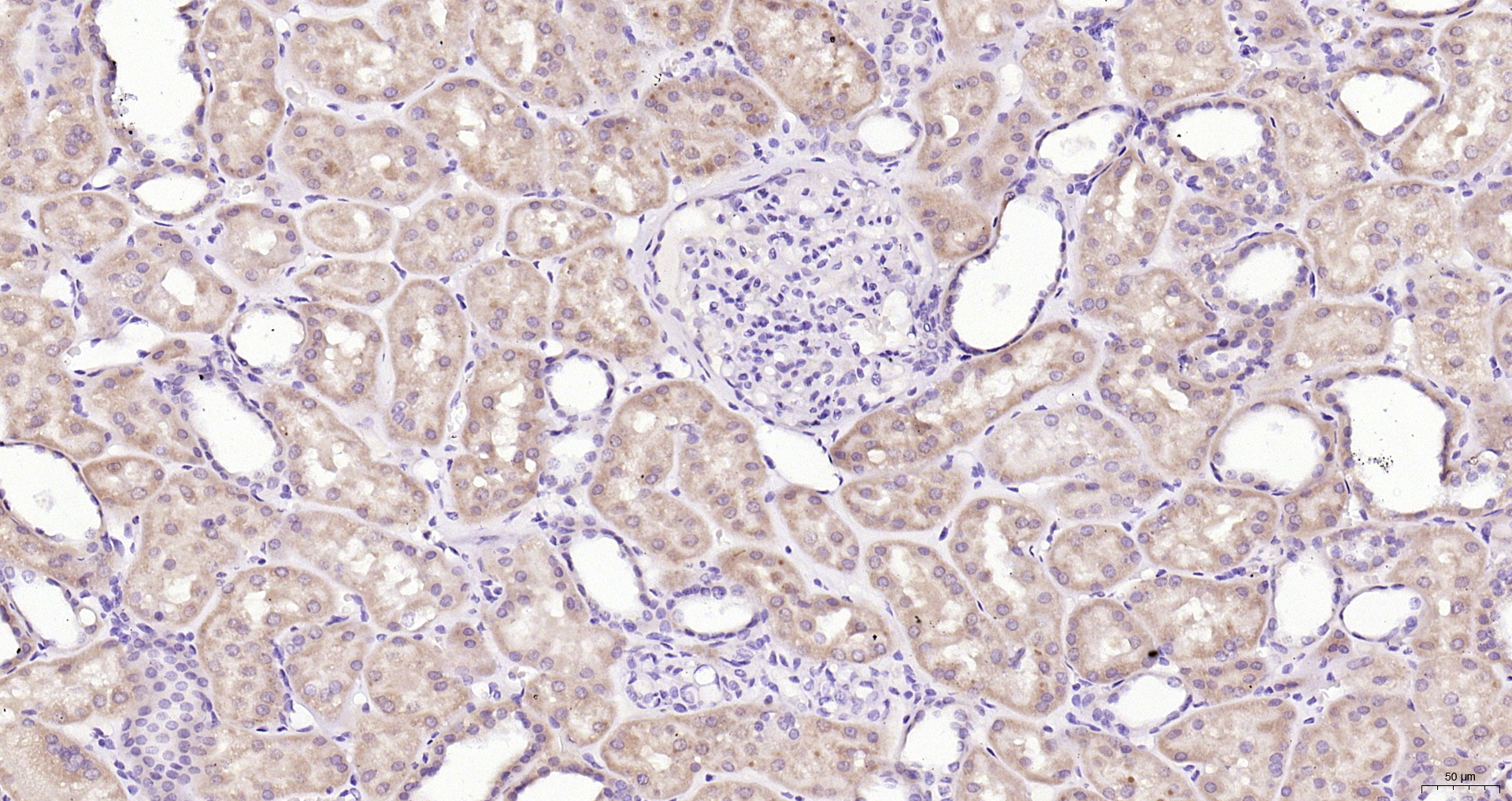 Paraformaldehyde-fixed, paraffin embedded (Human kidney ); Antigen retrieval by boiling in sodium citrate buffer (pH6.0) for 15min; Block endogenous peroxidase by 3% hydrogen peroxide for 20 minutes; Blocking buffer (normal goat serum) at 37°C for 30min; Antibody incubation with (DIP2B) Polyclonal Antibody, Unconjugated (bs-14332R) at 1:400 overnight at 4°C, followed by operating according to SP Kit(Rabbit) (sp-0023) instructionsand DAB staining.