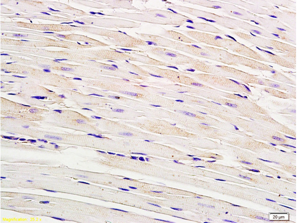 Formalin-fixed and paraffin embedded rat myocardium tissue labeled with Anti-Connexin-40 Polyclonal Antibody, Unconjugated (bs-1050R) at 1:200, followed by conjugation to the secondary antibody and DAB staining
