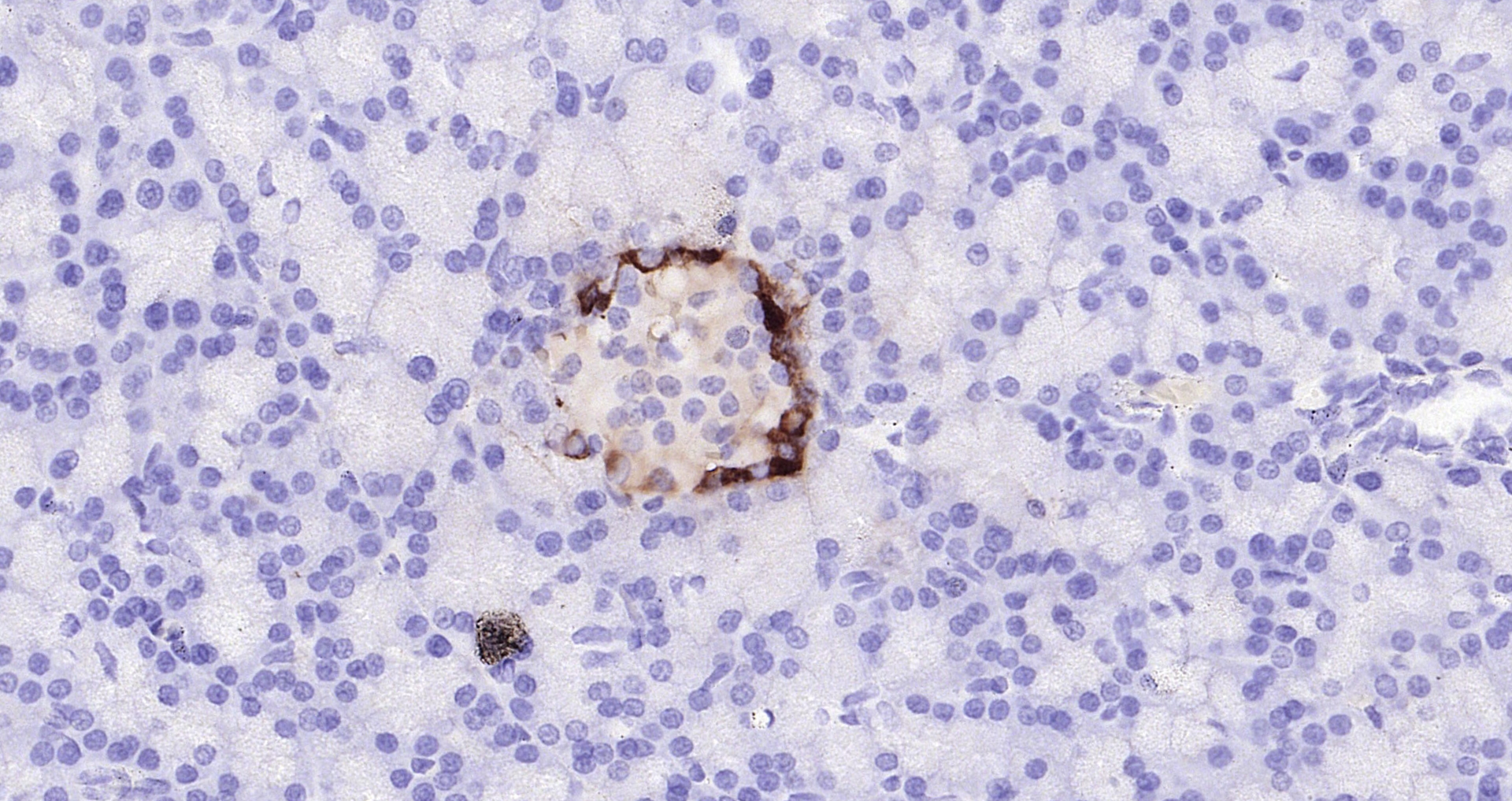 Paraformaldehyde-fixed, paraffin embedded (mouse pancreas); Antigen retrieval by boiling in sodium citrate buffer (pH6.0) for 15min; Block endogenous peroxidase by 3% hydrogen peroxide for 20 minutes; Blocking buffer (normal goat serum) at 37°C for 30min; Antibody incubation with (GLP-1(1G9)) Monoclonal Antibody, Unconjugated (bsm-0933M) at 1:200 overnight at 4°C, followed by operating according to SP Kit(Mouse)(sp-0024 bs-0296G-Bio 1:1000) instructionsand DAB staining. Paraformaldehyde-fixed, paraffin embedded (mouse pancreas); Antigen retrieval by boiling in sodium citrate buffer (pH6.0) for 15min; Block endogenous peroxidase by 3% hydrogen peroxide for 20 minutes; Blocking buffer (normal goat serum) at 37°C for 30min; Antibody incubation with (GLP-1(1G9)) Monoclonal Antibody, Unconjugated (bsm-0933M) at 1:200 overnight at 4°C, followed by operating according to SP Kit(Mouse)(sp-0024 bs-0296G-Bio 1:1000) instructionsand DAB staining.