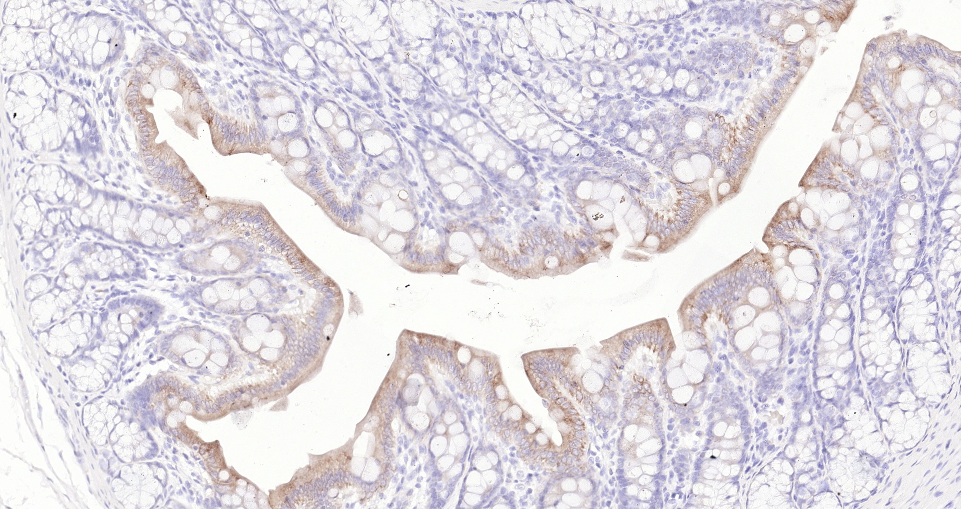 Paraformaldehyde-fixed, paraffin embedded (rat colon); Antigen retrieval by boiling in sodium citrate buffer (pH6.0) for 15min; Block endogenous peroxidase by 3% hydrogen peroxide for 20 minutes; Blocking buffer (normal goat serum) at 37°C for 30min; Antibody incubation with (Cytokeratin 8) Monoclonal Antibody, Unconjugated (bsm-33061M) at 1:200 overnight at 4°C, followed by operating according to SP Kit(Mouse)(sp-0024 bs-0296G-Bio 1:2000) instructionsand DAB staining.