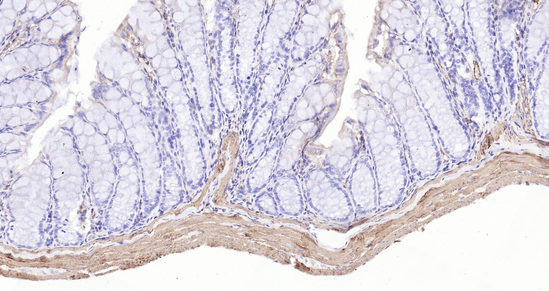 Paraformaldehyde-fixed, paraffin embedded (mouse colon); Antigen retrieval by boiling in sodium citrate buffer (pH6.0) for 15min; Block endogenous peroxidase by 3% hydrogen peroxide for 20 minutes; Blocking buffer (normal goat serum) at 37°C for 30min; Antibody incubation with (alpha smooth muscle Actin) Monoclonal Antibody, Unconjugated (bsm-33187M) at 1:200 overnight at 4°C, followed by operating according to SP Kit(Mouse)(sp-0024 bs-0296G-Bio 1:500) instructionsand DAB staining.