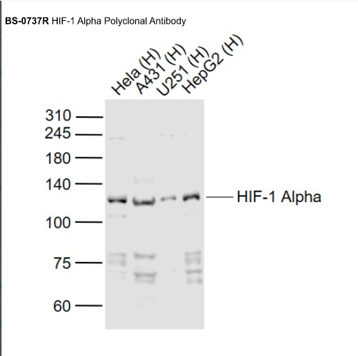 Lane 1: Human Hela cell lysates; Lane 2: Human A431 cell lysates; Lane 3: Human U251 cell lysates; Lane 4: Human HepG2 cell lysates probed with HIF-1 Alpha Polyclonal Antibody, Unconjugated (bs-0737R) at 1:1000 dilution and 4˚C overnight incubation. Followed by conjugated secondary antibody incubation at 1:20000 for 60 min at 37˚C.