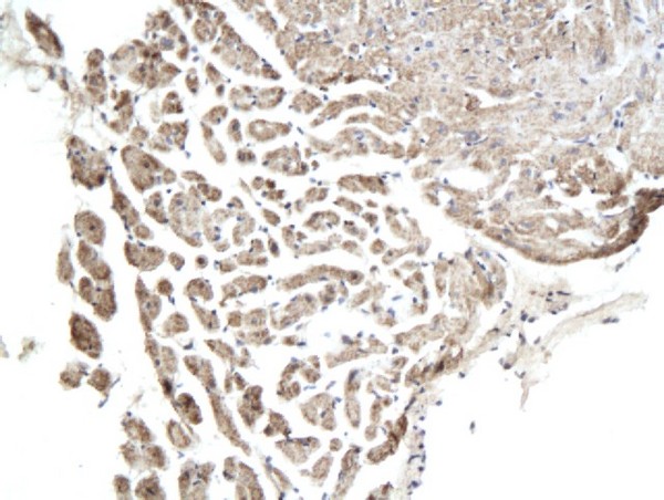 Formalin-fixed and paraffin embedded rat myocardial tissue labeled with Anti-Connexin-36 Polyclonal Antibody, Unconjugated (bs-1266R) followed by conjugation to the secondary antibody and DAB staining