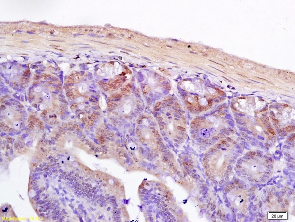 Formalin-fixed and paraffin embedded rat ileum labeled with Anti-TCF7L2 Polyclonal Antibody, Unconjugated (bs-1280R) followed by conjugation to the secondary antibody and DAB staining