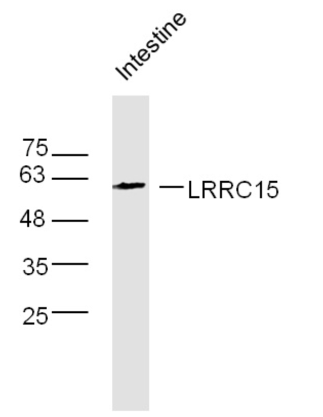 Mouse Intestine lysates (40ug) probed with LRRC15 Polyclonal Antibody, unconjugated (bs-6815R) at 1:300 overnight at 4°C followed by a conjugated secondary antibody for 60 minutes at 37°C. Mouse Intestine lysates (40ug) probed with LRRC15 Polyclonal Antibody, unconjugated (bs-6815R) at 1:300 overnight at 4°C followed by a conjugated secondary antibody for 60 minutes at 37°C.