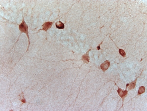 Mouse hippocampus labeled with Anti-GAD-67 Polyclonal Antibody, Unconjugated (bs-1302R) followed by conjugation to the secondary antibody and DAB staining