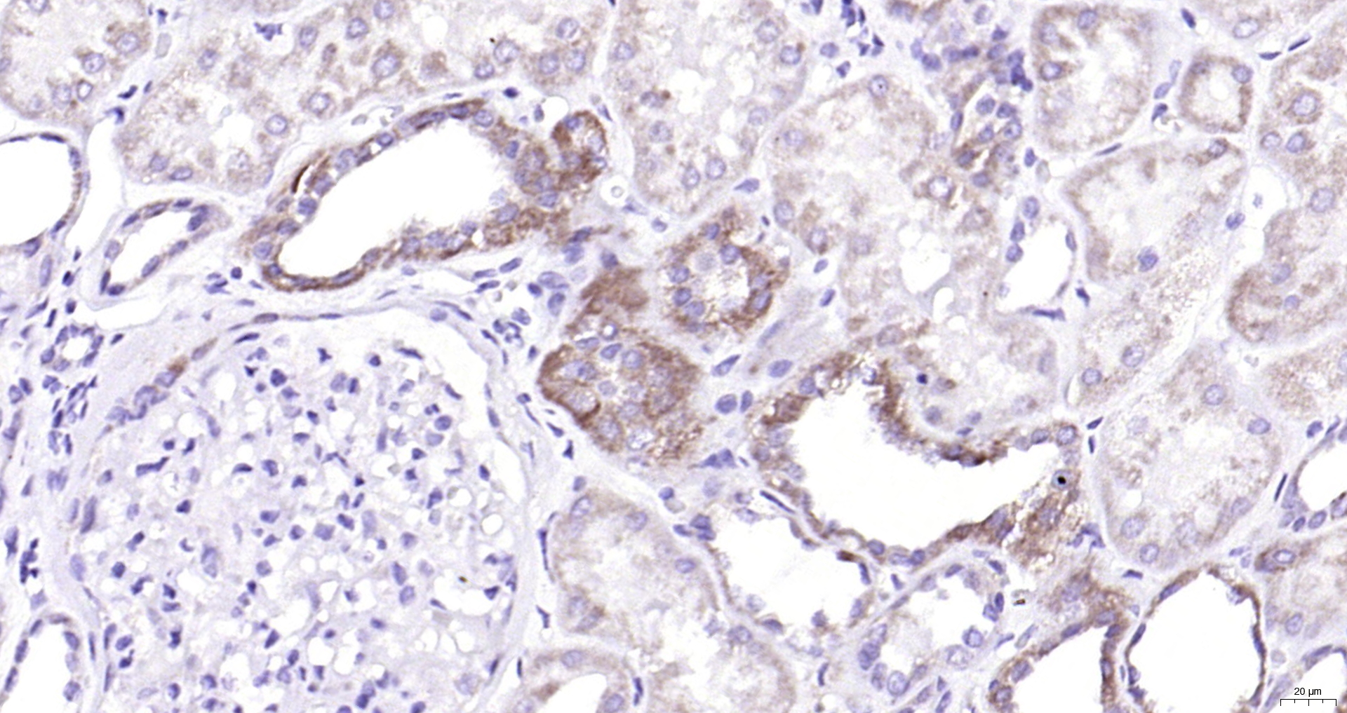 Paraformaldehyde-fixed, paraffin embedded (Human kidney); Antigen retrieval by boiling in sodium citrate buffer (pH6.0) for 15min; Block endogenous peroxidase by 3% hydrogen peroxide for 20 minutes; Blocking buffer (normal goat serum) at 37°C for 30min; Antibody incubation with (TSLP) Polyclonal Antibody, Unconjugated (bs-0449R) at 1:200 overnight at 4°C, followed by operating according to SP Kit(Rabbit) (sp-0023) instructionsand DAB staining.