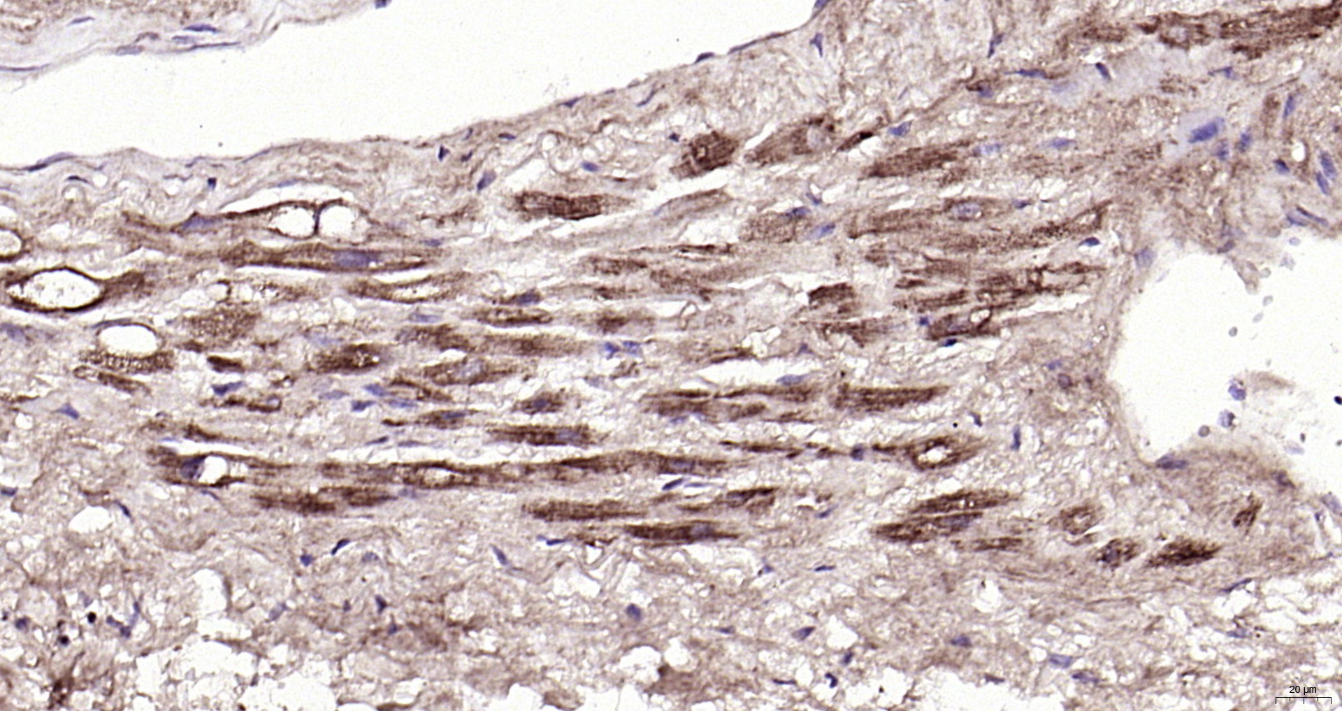 Paraformaldehyde-fixed, paraffin embedded (Human heart); Antigen retrieval by boiling in sodium citrate buffer (pH6.0) for 15min; Block endogenous peroxidase by 3% hydrogen peroxide for 20 minutes; Blocking buffer (normal goat serum) at 37°C for 30min; Antibody incubation with (TSLP) Polyclonal Antibody, Unconjugated (bs-0449R) at 1:200 overnight at 4°C, followed by operating according to SP Kit(Rabbit) (sp-0023) instructionsand DAB staining.