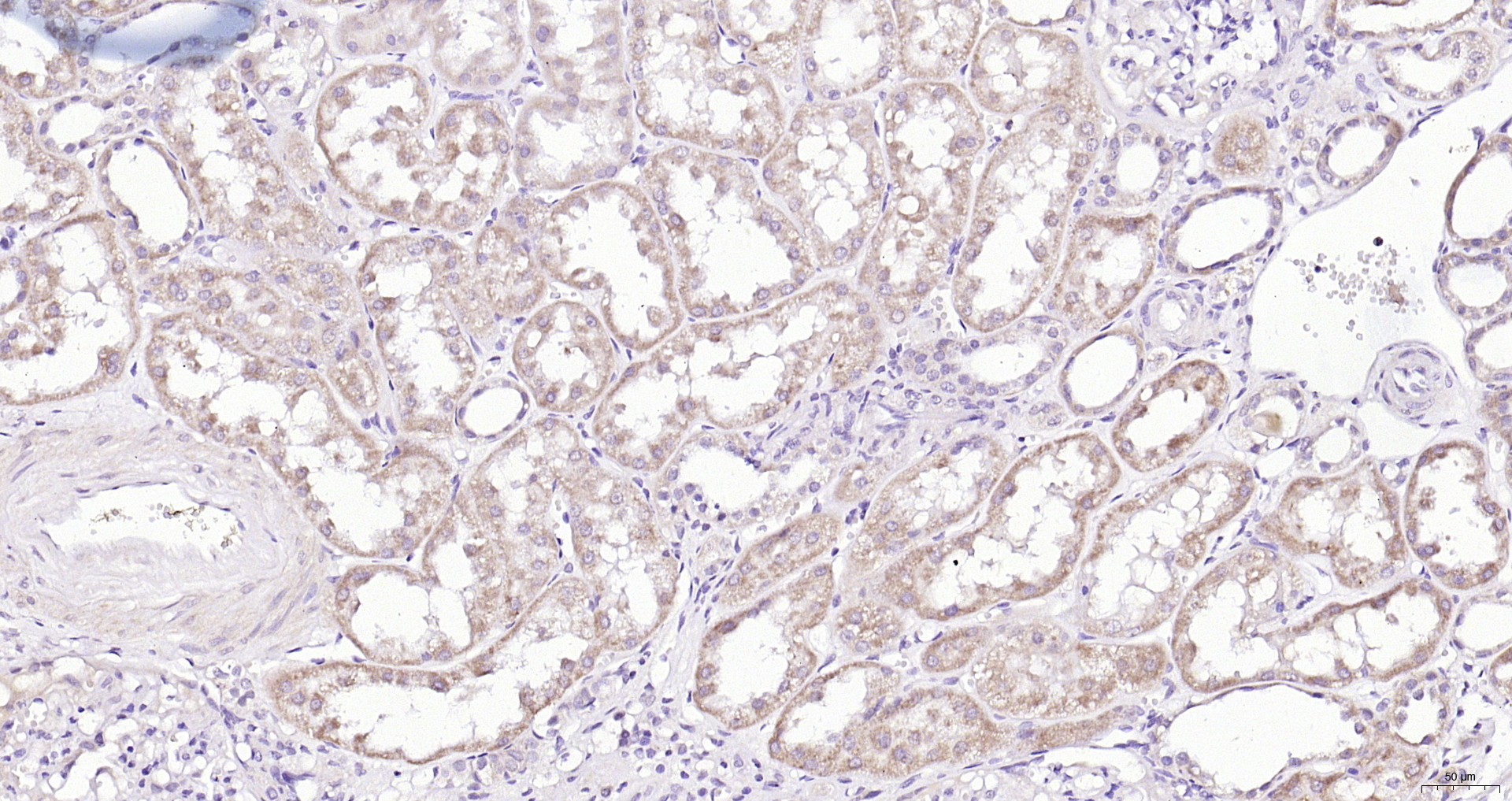 Paraformaldehyde-fixed, paraffin embedded (Human kidney); Antigen retrieval by boiling in sodium citrate buffer (pH6.0) for 15min; Block endogenous peroxidase by 3% hydrogen peroxide for 20 minutes; Blocking buffer (normal goat serum) at 37°C for 30min; Antibody incubation with (Sclerostin) Polyclonal Antibody, Unconjugated (bs-10200R) at 1:200 overnight at 4°C, followed by operating according to SP Kit(Rabbit) (sp-0023) instructionsand DAB staining.