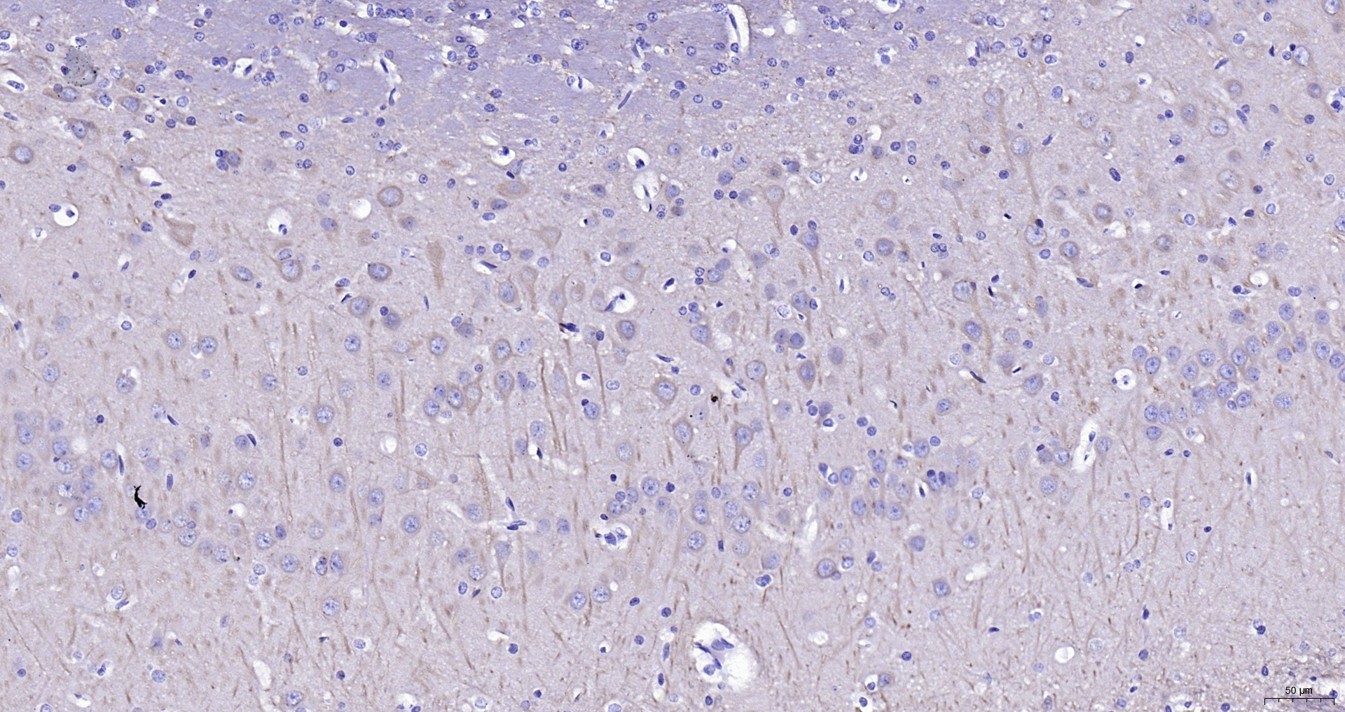 Paraformaldehyde-fixed, paraffin embedded (rat brain); Antigen retrieval by boiling in sodium citrate buffer (pH6.0) for 15min; Block endogenous peroxidase by 3% hydrogen peroxide for 20 minutes; Blocking buffer (normal goat serum) at 37°C for 30min; Antibody incubation with (TUBB3 (Neuronal Marker) ) Monoclonal Antibody, Unconjugated (ascites of bsm-33177M 6F12) at 1:2000 overnight at 4°C, followed by operating according to SP Kit(Mouse) (sp-0024) instructions and DAB staining.