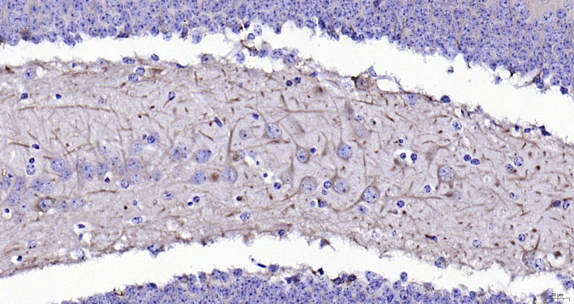 Paraformaldehyde-fixed, paraffin embedded (mouse brain); Antigen retrieval by boiling in sodium citrate buffer (pH6.0) for 15min; Block endogenous peroxidase by 3% hydrogen peroxide for 20 minutes; Blocking buffer (normal goat serum) at 37°C for 30min; Antibody incubation with (TUBB3 (Neuronal Marker) ) Monoclonal Antibody, Unconjugated (ascites of bsm-33177M 6F12) at 1:2000 overnight at 4°C, followed by operating according to SP Kit(Mouse) (sp-0024) instructions and DAB staining.