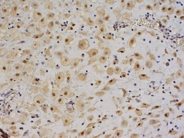 Formalin-fixed and paraffin embedded human pancreas labeled with Anti-IGF II\/IGF2 Polyclonal Antibody, Unconjugated (bs-0015R), followed by conjugation to the secondary antibody and DAB staining
