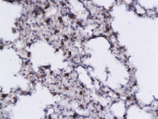 Formalin-fixed and paraffin embedded mouse lung tissue labeled with Anti- IL-5 Polyclonal Antibody, Unconjugated (bs-1318R) followed by conjugation to the secondary antibody and DAB staining