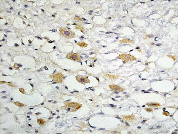Formalin-fixed and paraffin embedded rat brain labeled with Anti- ZO-1 Polyclonal Antibody, Unconjugated (bs-1329R) followed by conjugation to the secondary antibody and DAB staining