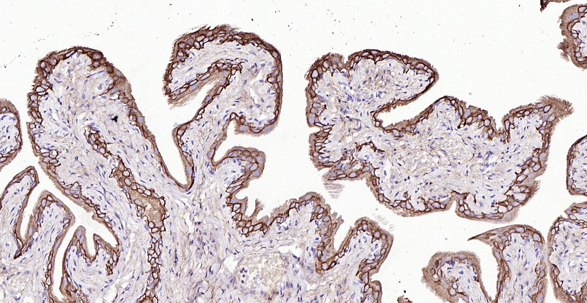 Paraformaldehyde-fixed, paraffin embedded (Rat bladder); Antigen retrieval by boiling in sodium citrate buffer (pH6.0) for 15min; Block endogenous peroxidase by 3% hydrogen peroxide for 20 minutes; Blocking buffer (normal goat serum) at 37°C for 30min; Antibody incubation with (CK7) Polyclonal Antibody, Unconjugated (bs-1744R) at 1:200 overnight at 4°C, followed by operating according to SP Kit(Rabbit) (sp-0023) instructionsand DAB staining.