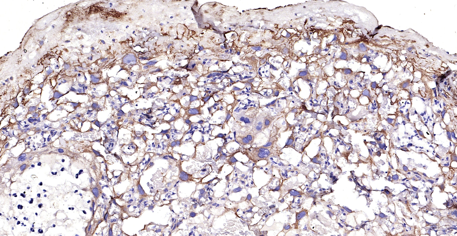 Paraformaldehyde-fixed, paraffin embedded (Rat placenta); Antigen retrieval by boiling in sodium citrate buffer (pH6.0) for 15min; Block endogenous peroxidase by 3% hydrogen peroxide for 20 minutes; Blocking buffer (normal goat serum) at 37°C for 30min; Antibody incubation with (CK7) Polyclonal Antibody, Unconjugated (bs-1744R) at 1:200 overnight at 4°C, followed by operating according to SP Kit(Rabbit) (sp-0023) instructionsand DAB staining.