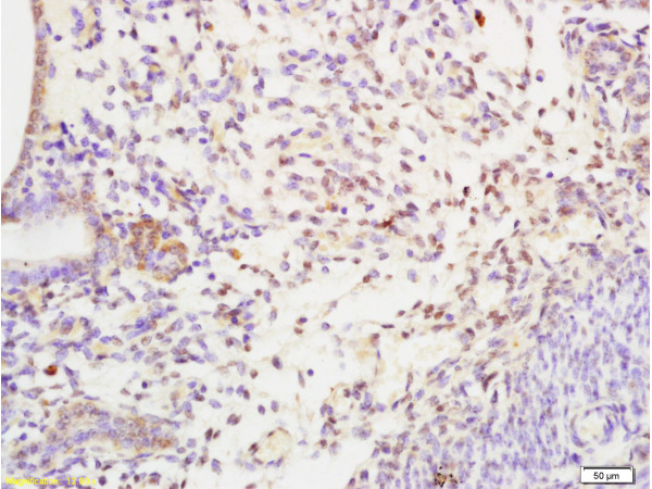 Formalin-fixed and paraffin embedded rat uterus tissue labeled with Anti-SHBG Polyclonal Antibody, Unconjugated(bs-1175R) at 1:200 followed by conjugation to the secondary antibody and DAB staining