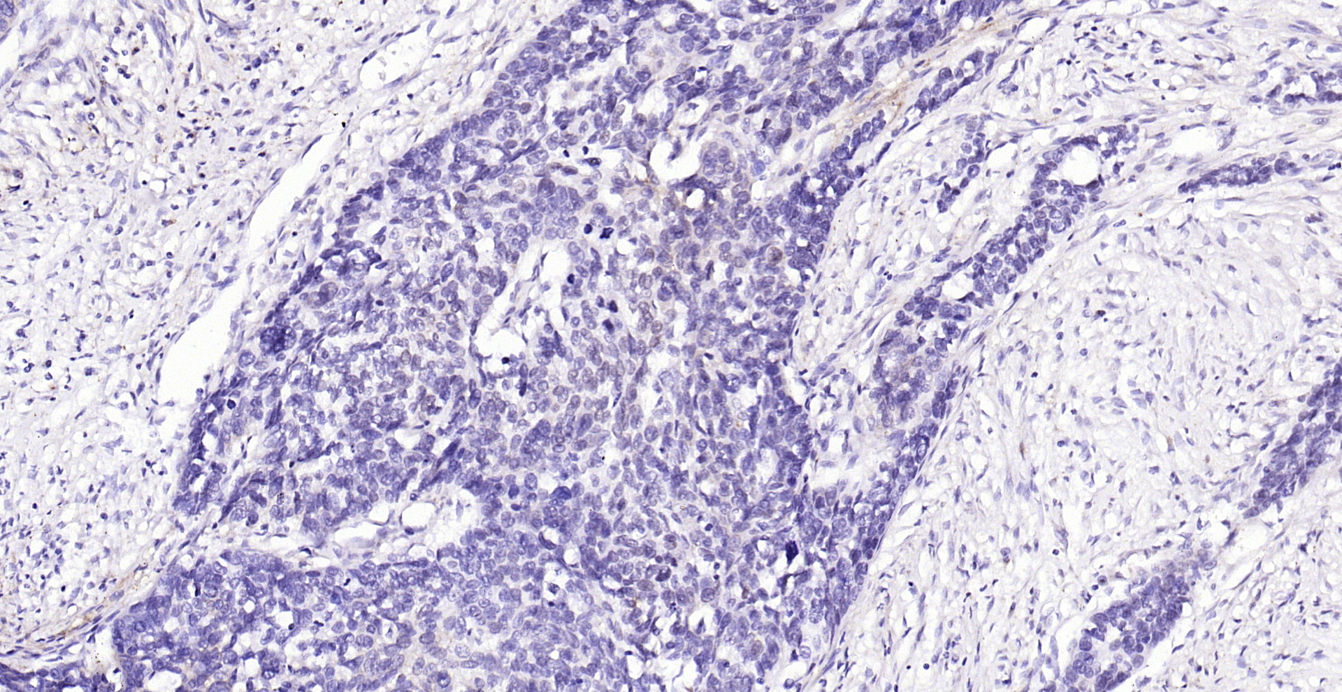 Paraformaldehyde-fixed, paraffin embedded (human esophageal cancer); Antigen retrieval by boiling in sodium citrate buffer (pH6.0) for 15min; Block endogenous peroxidase by 3% hydrogen peroxide for 20 minutes; Blocking buffer (normal goat serum) at 37°C for 30min; Antibody incubation with (Phospho-YAP1 (Tyr407)) Polyclonal Antibody, Unconjugated (bs-3476R) at 1:200 overnight at 4°C, followed by operating according to SP Kit(Rabbit) (sp-0023) instructionsand DAB staining.