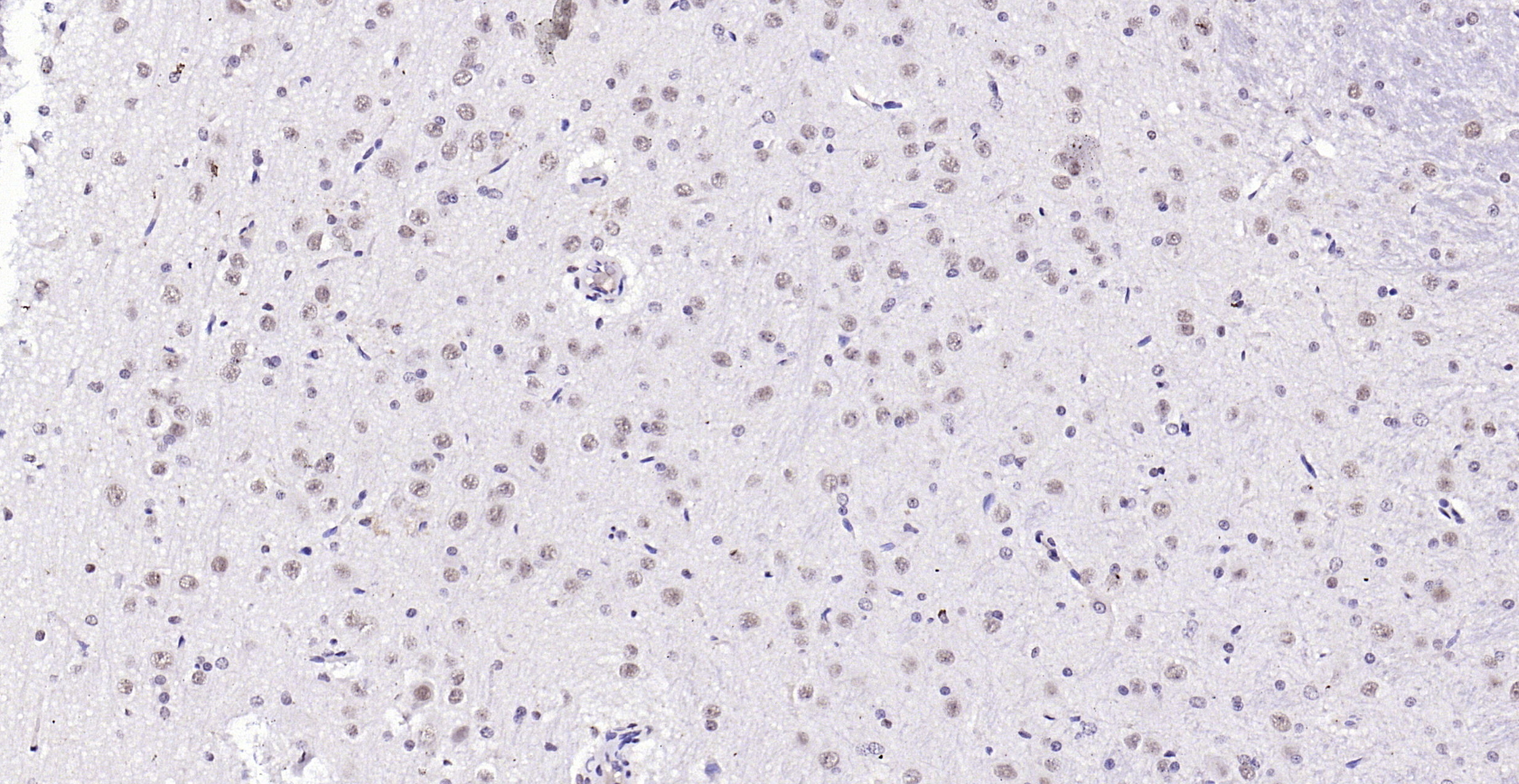 Paraformaldehyde-fixed, paraffin embedded (rat brain); Antigen retrieval by boiling in sodium citrate buffer (pH6.0) for 15min; Block endogenous peroxidase by 3% hydrogen peroxide for 20 minutes; Blocking buffer (normal goat serum) at 37°C for 30min; Antibody incubation with (Notch3) Polyclonal Antibody, Unconjugated (bs-1812R) at 1:200 overnight at 4°C, followed by operating according to SP Kit(Rabbit) (sp-0023) instructionsand DAB staining.