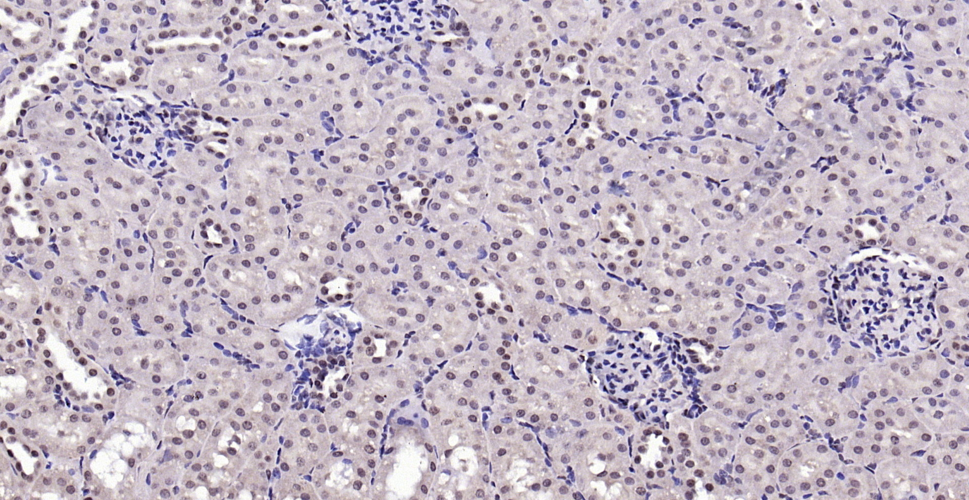 Paraformaldehyde-fixed, paraffin embedded (rat kidney); Antigen retrieval by boiling in sodium citrate buffer (pH6.0) for 15min; Block endogenous peroxidase by 3% hydrogen peroxide for 20 minutes; Blocking buffer (normal goat serum) at 37°C for 30min; Antibody incubation with (Notch3) Polyclonal Antibody, Unconjugated (bs-1812R) at 1:200 overnight at 4°C, followed by operating according to SP Kit(Rabbit) (sp-0023) instructionsand DAB staining.