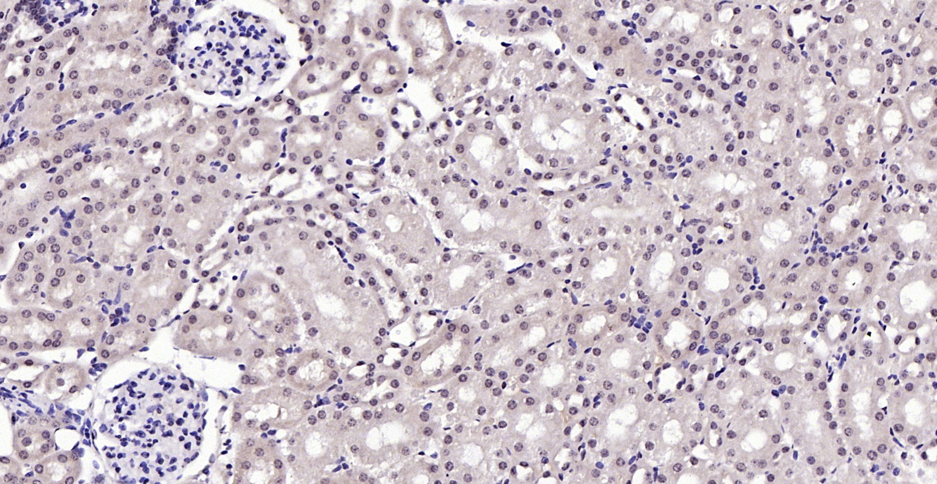 Paraformaldehyde-fixed, paraffin embedded (mouse kidney); Antigen retrieval by boiling in sodium citrate buffer (pH6.0) for 15min; Block endogenous peroxidase by 3% hydrogen peroxide for 20 minutes; Blocking buffer (normal goat serum) at 37°C for 30min; Antibody incubation with (Notch3) Polyclonal Antibody, Unconjugated (bs-1812R) at 1:200 overnight at 4°C, followed by operating according to SP Kit(Rabbit) (sp-0023) instructionsand DAB staining.