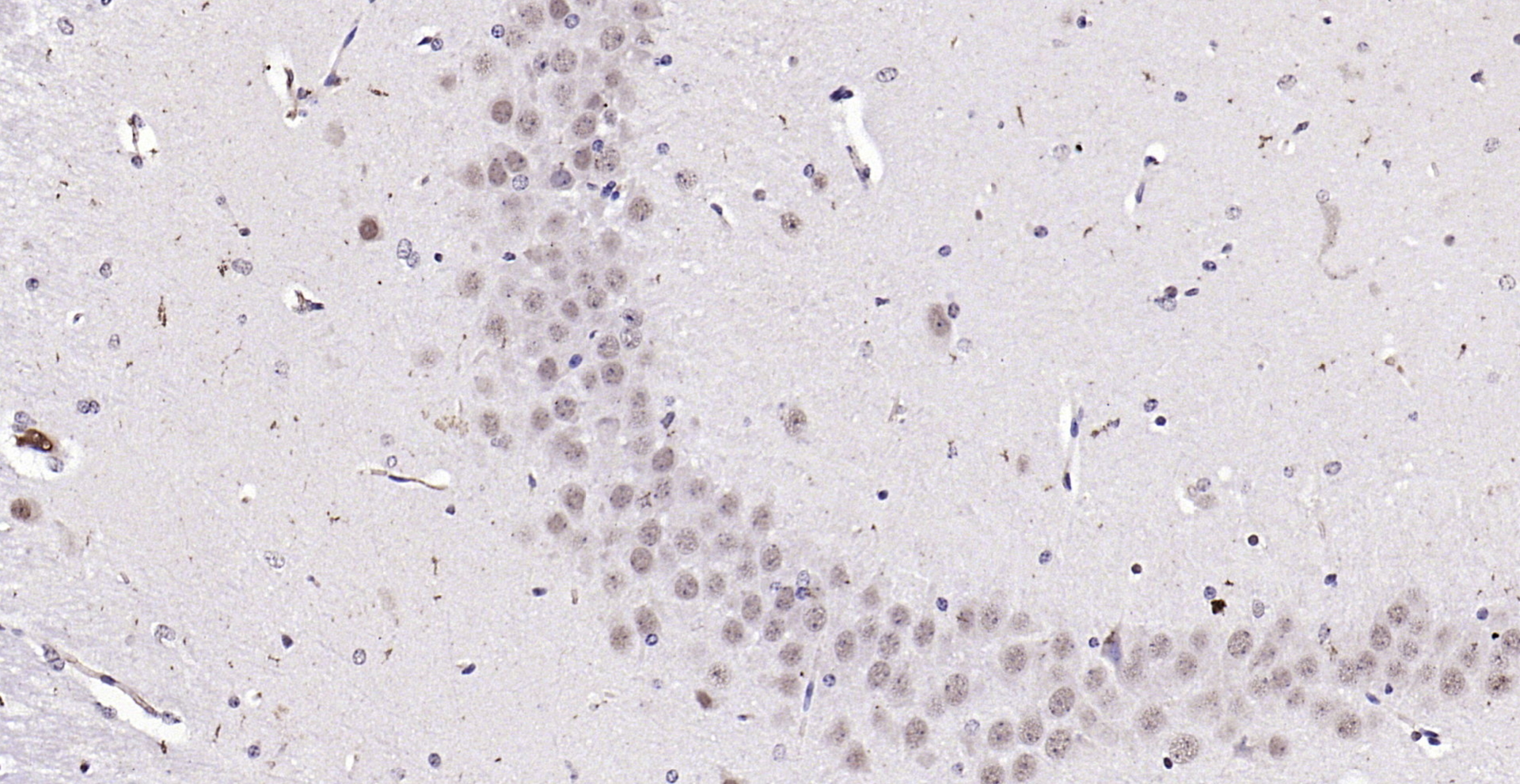 Paraformaldehyde-fixed, paraffin embedded (mouse brain); Antigen retrieval by boiling in sodium citrate buffer (pH6.0) for 15min; Block endogenous peroxidase by 3% hydrogen peroxide for 20 minutes; Blocking buffer (normal goat serum) at 37°C for 30min; Antibody incubation with (Notch3) Polyclonal Antibody, Unconjugated (bs-1812R) at 1:200 overnight at 4°C, followed by operating according to SP Kit(Rabbit) (sp-0023) instructionsand DAB staining.