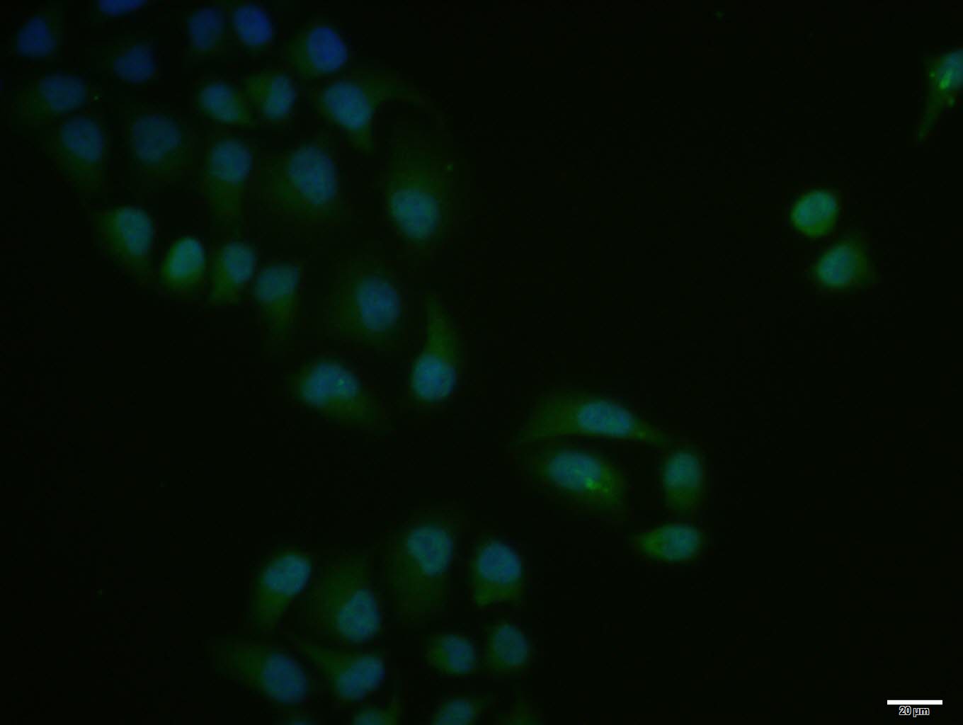 Hela cell; 4% Paraformaldehyde-fixed; Triton X-100 at room temperature for 20 min; Blocking buffer (normal goat serum, C-0005) at 37°C for 20 min; Antibody incubation with (NF1) polyclonal Antibody, Unconjugated (bs-4140R) 1:100, 90 minutes at 37°C; followed by a conjugated Goat Anti-Rabbit IgG antibody at 37°C for 90 minutes, DAPI (blue, C02-04002) was used to stain the cell nuclei.