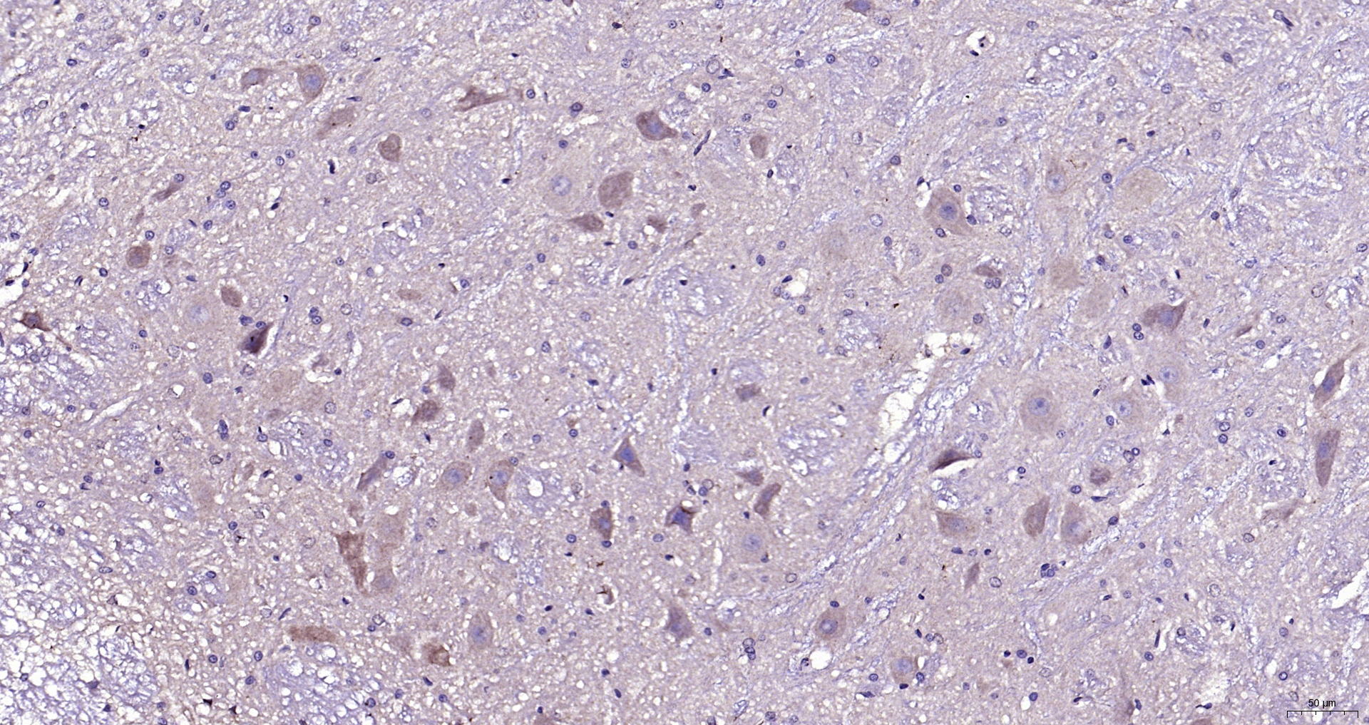 Paraformaldehyde-fixed, paraffin embedded (Rat cerebellum); Antigen retrieval by boiling in sodium citrate buffer (pH6.0) for 15min; Block endogenous peroxidase by 3% hydrogen peroxide for 20 minutes; Blocking buffer (normal goat serum) at 37°C for 30min; Antibody incubation with (CaMK2b) Polyclonal Antibody, Unconjugated (bs-0541R) at 1:200 overnight at 4°C, followed by operating according to SP Kit(Rabbit) (sp-0023) instructionsand DAB staining.