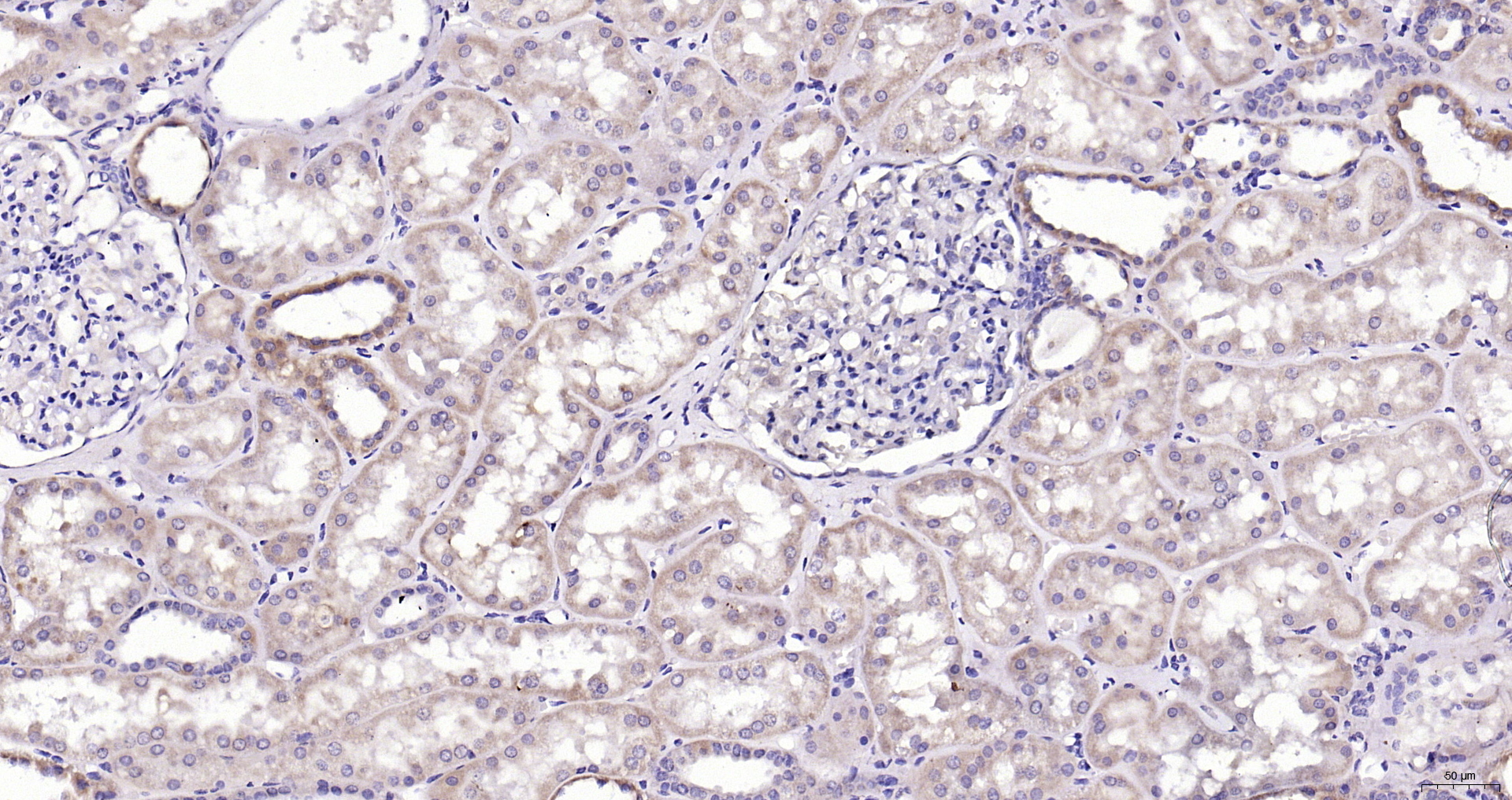 Paraformaldehyde-fixed, paraffin embedded (Human kidney); Antigen retrieval by boiling in sodium citrate buffer (pH6.0) for 15min; Block endogenous peroxidase by 3% hydrogen peroxide for 20 minutes; Blocking buffer (normal goat serum) at 37°C for 30min; Antibody incubation with (CaMKII (Thr286)) Polyclonal Antibody, Unconjugated (bs-1647R) at 1:400 overnight at 4°C, followed by operating according to SP Kit(Rabbit) (sp-0023) instructionsand DAB staining. Paraformaldehyde-fixed, paraffin embedded (Human kidney); Antigen retrieval by boiling in sodium citrate buffer (pH6.0) for 15min; Block endogenous peroxidase by 3% hydrogen peroxide for 20 minutes; Blocking buffer (normal goat serum) at 37°C for 30min; Antibody incubation with (CaMKII (Thr286)) Polyclonal Antibody, Unconjugated (bs-1647R) at 1:400 overnight at 4°C, followed by operating according to SP Kit(Rabbit) (sp-0023) instructionsand DAB staining.
