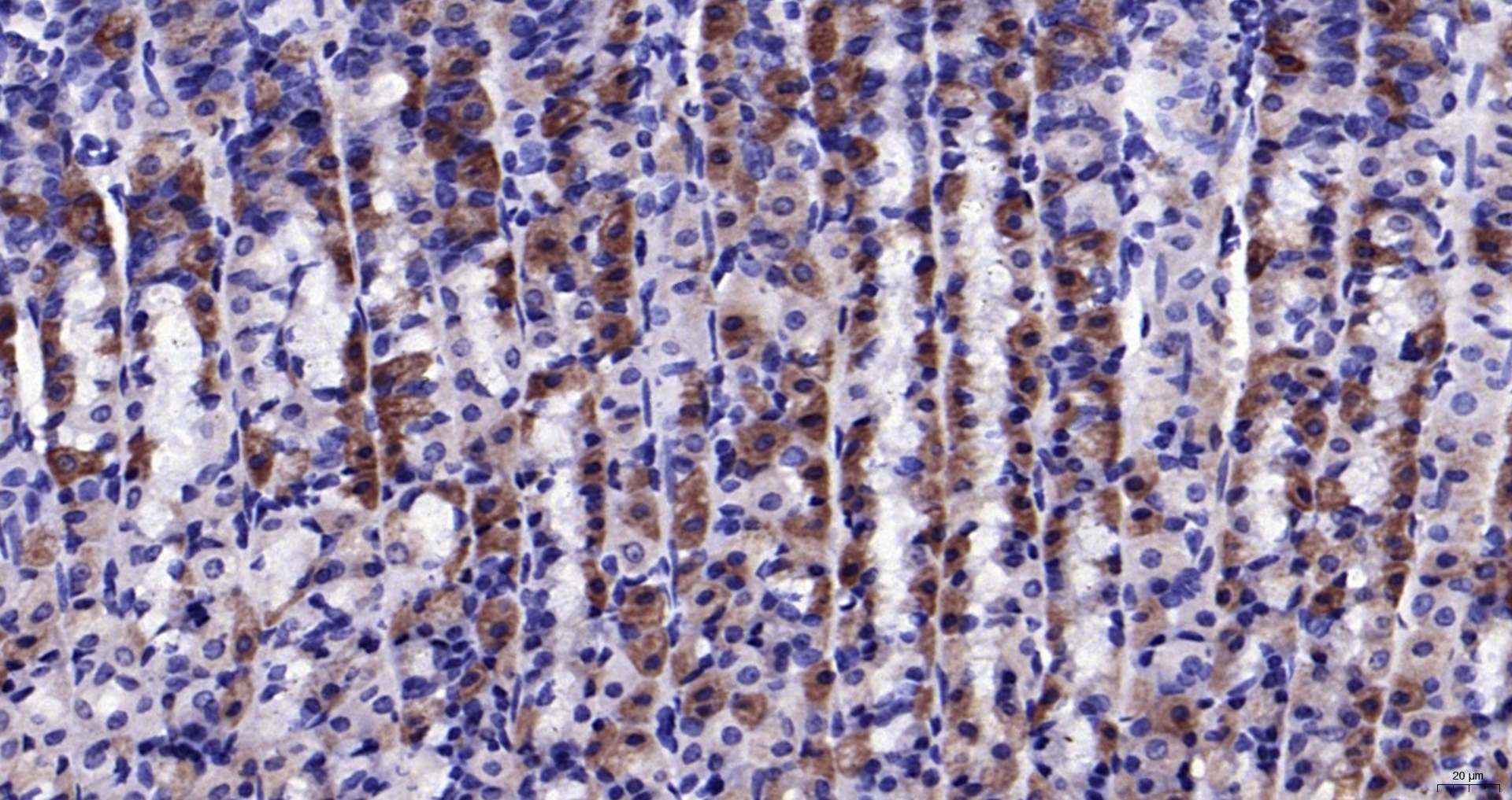 Paraformaldehyde-fixed, paraffin embedded (rat stomach); Antigen retrieval by boiling in sodium citrate buffer (pH6.0) for 15min; Block endogenous peroxidase by 3% hydrogen peroxide for 20 minutes; Blocking buffer (normal goat serum) at 37°C for 30min; Antibody incubation with (CaMKII (Thr286)) Polyclonal Antibody, Unconjugated (bs-1647R) at 1:200 overnight at 4°C, followed by operating according to SP Kit(Rabbit) (sp-0023) instructionsand DAB staining. Paraformaldehyde-fixed, paraffin embedded (rat stomach); Antigen retrieval by boiling in sodium citrate buffer (pH6.0) for 15min; Block endogenous peroxidase by 3% hydrogen peroxide for 20 minutes; Blocking buffer (normal goat serum) at 37°C for 30min; Antibody incubation with (CaMKII (Thr286)) Polyclonal Antibody, Unconjugated (bs-1647R) at 1:200 overnight at 4°C, followed by operating according to SP Kit(Rabbit) (sp-0023) instructionsand DAB staining.