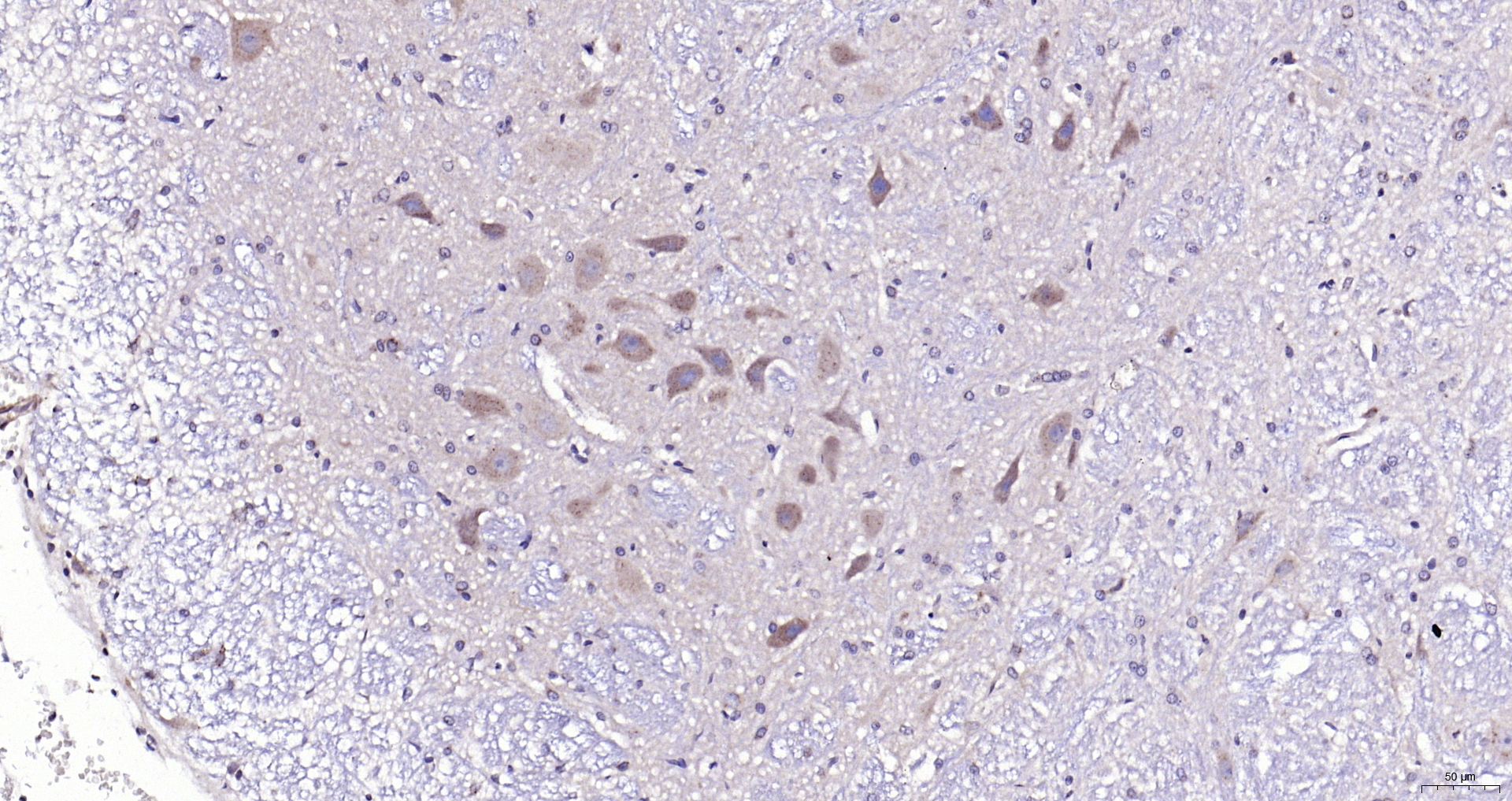 Paraformaldehyde-fixed, paraffin embedded (rat cerebellum)); Antigen retrieval by boiling in sodium citrate buffer (pH6.0) for 15min; Block endogenous peroxidase by 3% hydrogen peroxide for 20 minutes; Blocking buffer (normal goat serum) at 37°C for 30min; Antibody incubation with (CaMKII (Thr286)) Polyclonal Antibody, Unconjugated (bs-1647R) at 1:200 overnight at 4°C, followed by operating according to SP Kit(Rabbit) (sp-0023) instructionsand DAB staining. Paraformaldehyde-fixed, paraffin embedded (rat cerebellum)); Antigen retrieval by boiling in sodium citrate buffer (pH6.0) for 15min; Block endogenous peroxidase by 3% hydrogen peroxide for 20 minutes; Blocking buffer (normal goat serum) at 37°C for 30min; Antibody incubation with (CaMKII (Thr286)) Polyclonal Antibody, Unconjugated (bs-1647R) at 1:200 overnight at 4°C, followed by operating according to SP Kit(Rabbit) (sp-0023) instructionsand DAB staining.