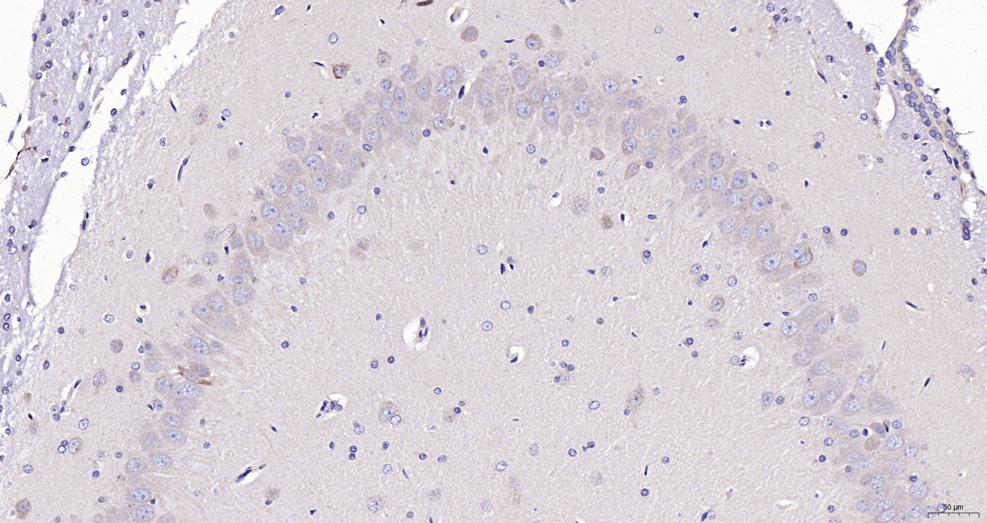 Paraformaldehyde-fixed, paraffin embedded (rat brain); Antigen retrieval by boiling in sodium citrate buffer (pH6.0) for 15min; Block endogenous peroxidase by 3% hydrogen peroxide for 20 minutes; Blocking buffer (normal goat serum) at 37°C for 30min; Antibody incubation with (NDUFV2) Polyclonal Antibody, Unconjugated (bs-3960R) at 1:200 overnight at 4°C, followed by operating according to SP Kit(Rabbit) (sp-0023) instructionsand DAB staining.