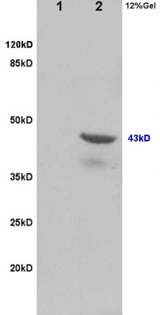 L1 rat brain lysates, L2 rat heart lysates probed with Anti-Tsg101 Polyclonal Antibody, Unconjugated (bs-1365R) at 1:200 in 4˚C. Followed by conjugation to secondary antibody (bs-0295G-HRP) at 1:3000 90min in 37˚C. Predicted band and observed band size: 42kD