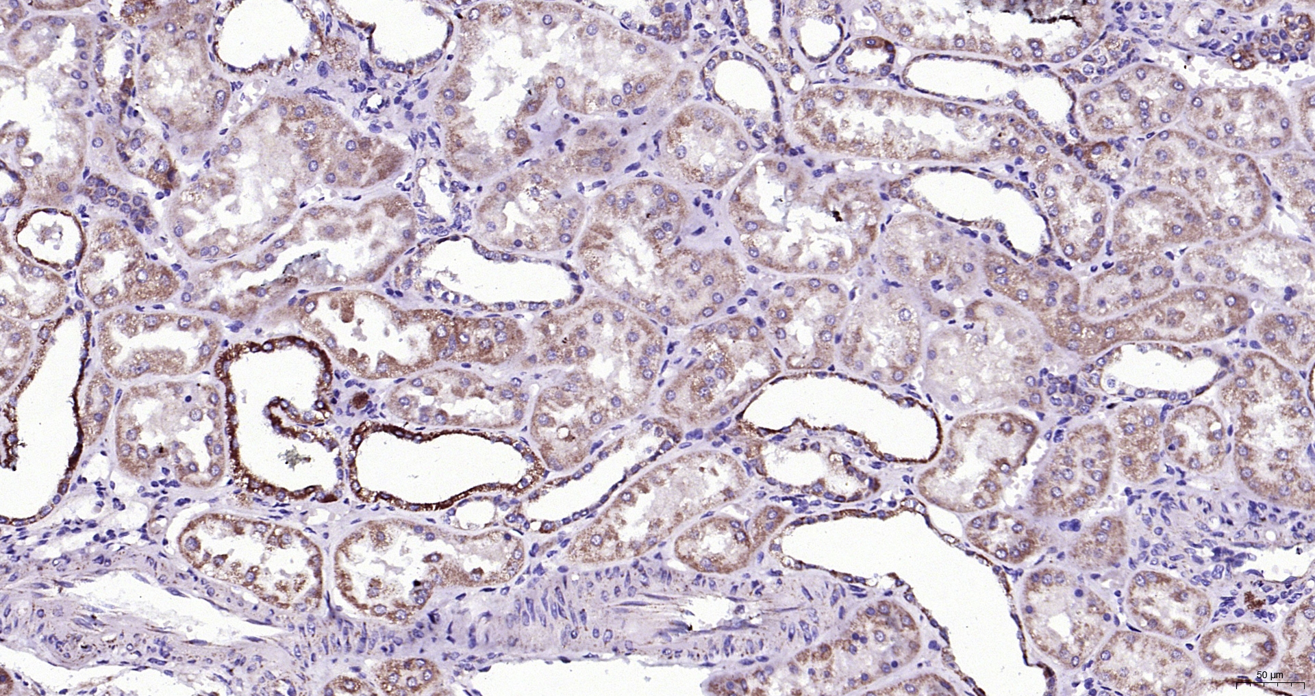 Paraformaldehyde-fixed, paraffin embedded (Human kidney); Antigen retrieval by boiling in sodium citrate buffer (pH6.0) for 15min; Block endogenous peroxidase by 3% hydrogen peroxide for 20 minutes; Blocking buffer (normal goat serum) at 37°C for 30min; Antibody incubation with (phospho-BAD (Ser128)) Polyclonal Antibody, Unconjugated (bs-0893R) at 1:200 overnight at 4°C, followed by operating according to SP Kit(Rabbit) (sp-0023) instructionsand DAB staining.