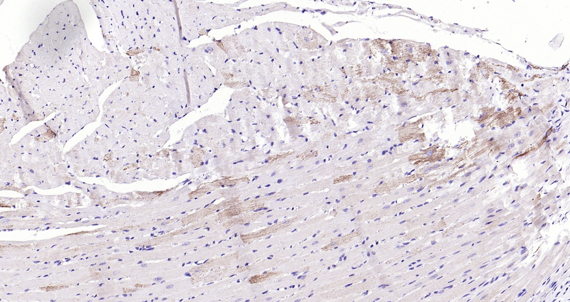 Paraformaldehyde-fixed, paraffin embedded (mouse heart); Antigen retrieval by boiling in sodium citrate buffer (pH6.0) for 15min; Block endogenous peroxidase by 3% hydrogen peroxide for 20 minutes; Blocking buffer (normal goat serum) at 37°C for 30min; Antibody incubation with (ILK-1 ) Polyclonal Antibody, Unconjugated (bs-0317R) at 1:200 overnight at 4°C, followed by operating according to SP Kit(Rabbit) (sp-0023) instructionsand DAB staining.