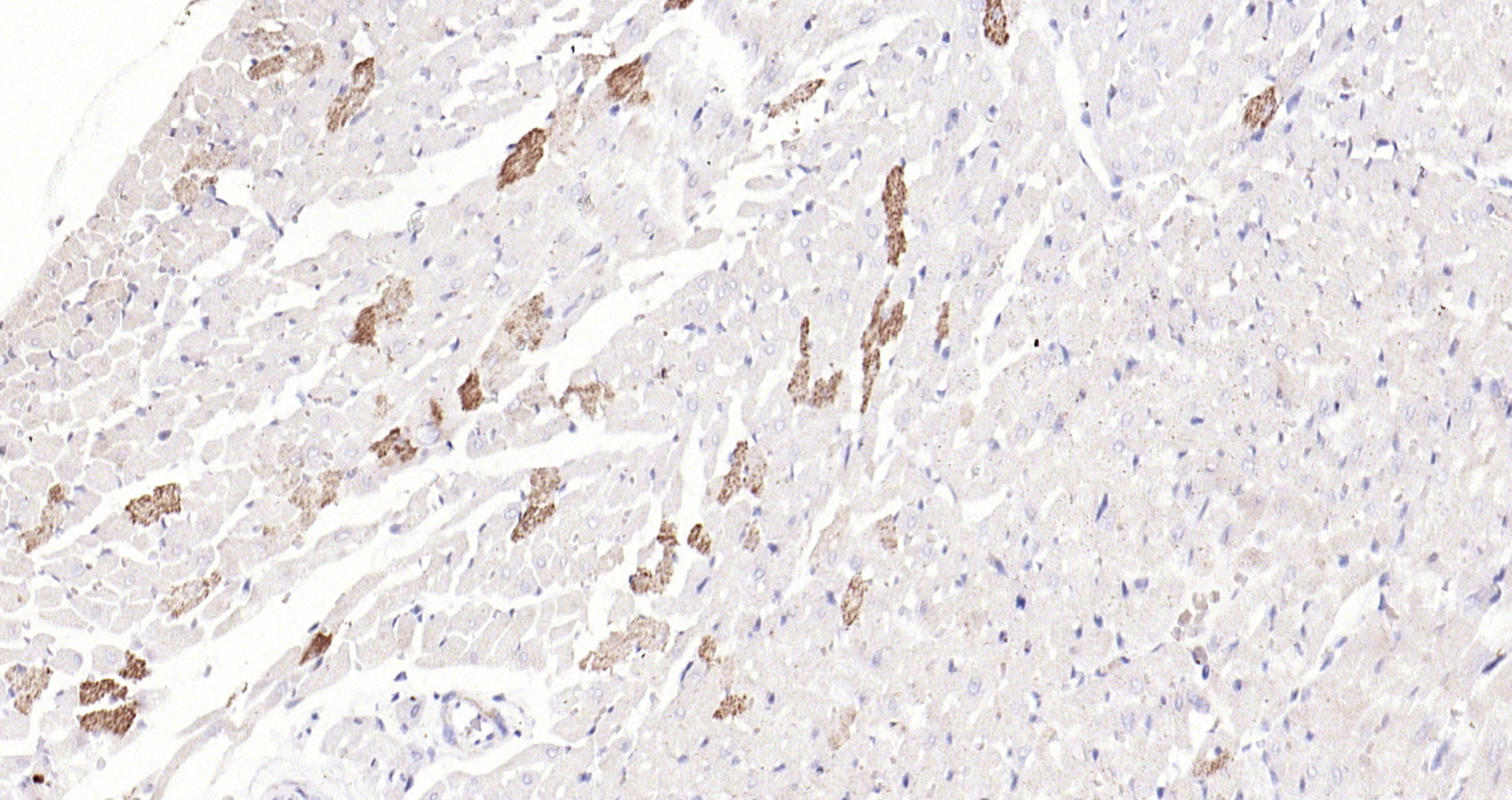 Paraformaldehyde-fixed, paraffin embedded (RAT heart); Antigen retrieval by boiling in sodium citrate buffer (pH6.0) for 15min; Block endogenous peroxidase by 3% hydrogen peroxide for 20 minutes; Blocking buffer (normal goat serum) at 37°C for 30min; Antibody incubation with (ILK-1 ) Polyclonal Antibody, Unconjugated (bs-0317R) at 1:200 overnight at 4°C, followed by operating according to SP Kit(Rabbit) (sp-0023) instructionsand DAB staining.