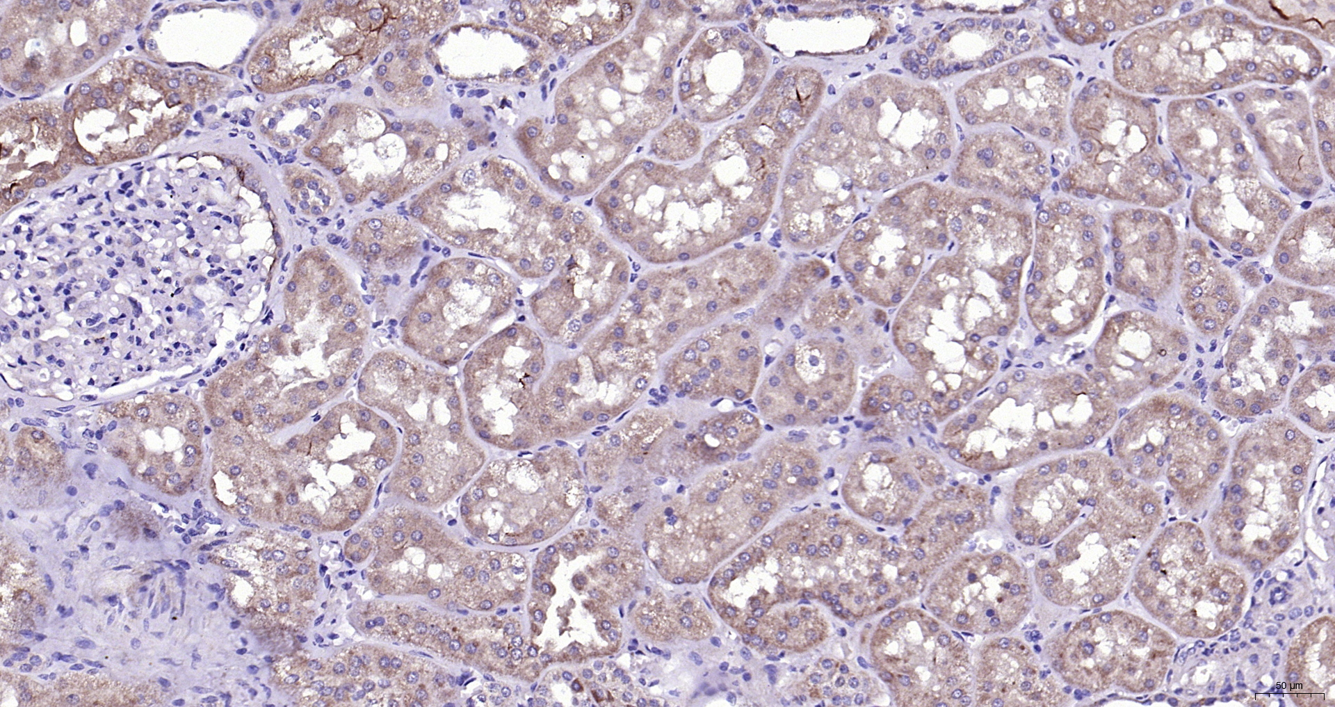 Paraformaldehyde-fixed, paraffin embedded (Human kidney); Antigen retrieval by boiling in sodium citrate buffer (pH6.0) for 15min; Block endogenous peroxidase by 3% hydrogen peroxide for 20 minutes; Blocking buffer (normal goat serum) at 37°C for 30min; Antibody incubation with (Bad ) Polyclonal Antibody, Unconjugated (bs-1304R) at 1:200 overnight at 4°C, followed by operating according to SP Kit(Rabbit) (sp-0023) instructionsand DAB staining.