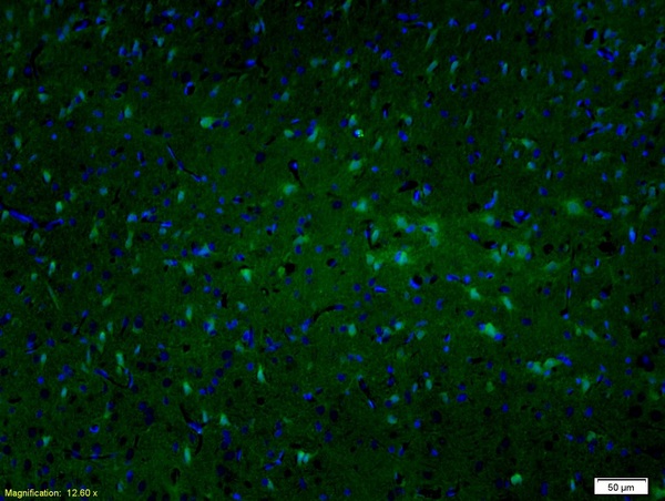 Formalin-fixed and paraffin embedded rat brain labeled with Anti-MAP2\/MAP-2A.B.C Polyclonal Antibody, Unconjugated (bs-1369R)  followed by conjugation to the secondary antibody and DAPI staining