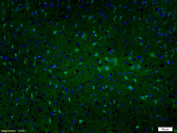 Formalin-fixed and paraffin embedded rat brain labeled with Anti-MAP2/MAP-2A.B.C Polyclonal Antibody, Unconjugated (bs-1369R) followed by conjugation to the secondary antibody and DAPI staining