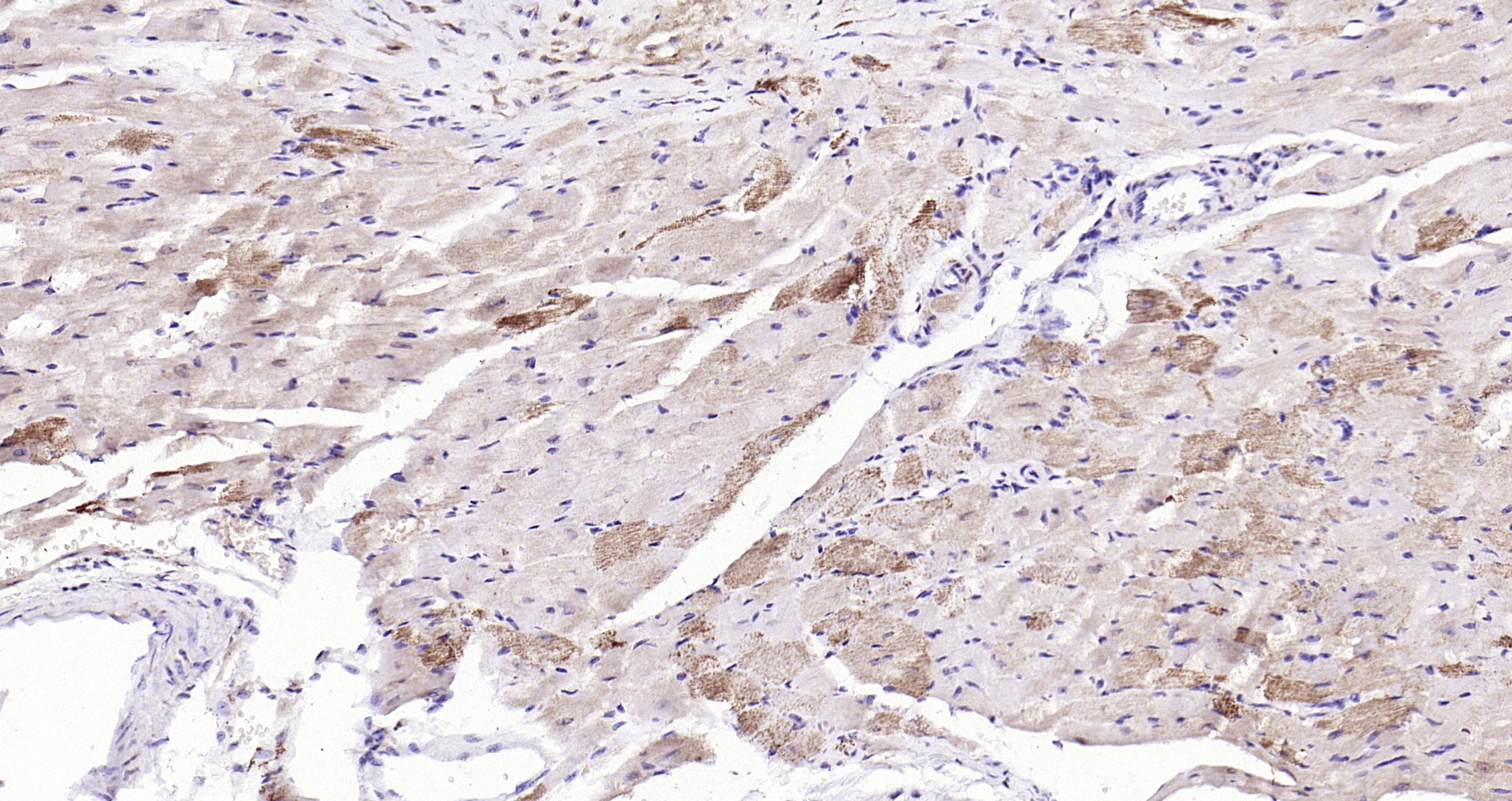 Paraformaldehyde-fixed, paraffin embedded (mouse heart); Antigen retrieval by boiling in sodium citrate buffer (pH6.0) for 15min; Block endogenous peroxidase by 3% hydrogen peroxide for 20 minutes; Blocking buffer (normal goat serum) at 37°C for 30min; Antibody incubation with (phospho-ASK1 (Ser966)) Polyclonal Antibody, Unconjugated (bs-3007R) at 1:200 overnight at 4°C, followed by operating according to SP Kit(Rabbit) (sp-0023) instructionsand DAB staining.