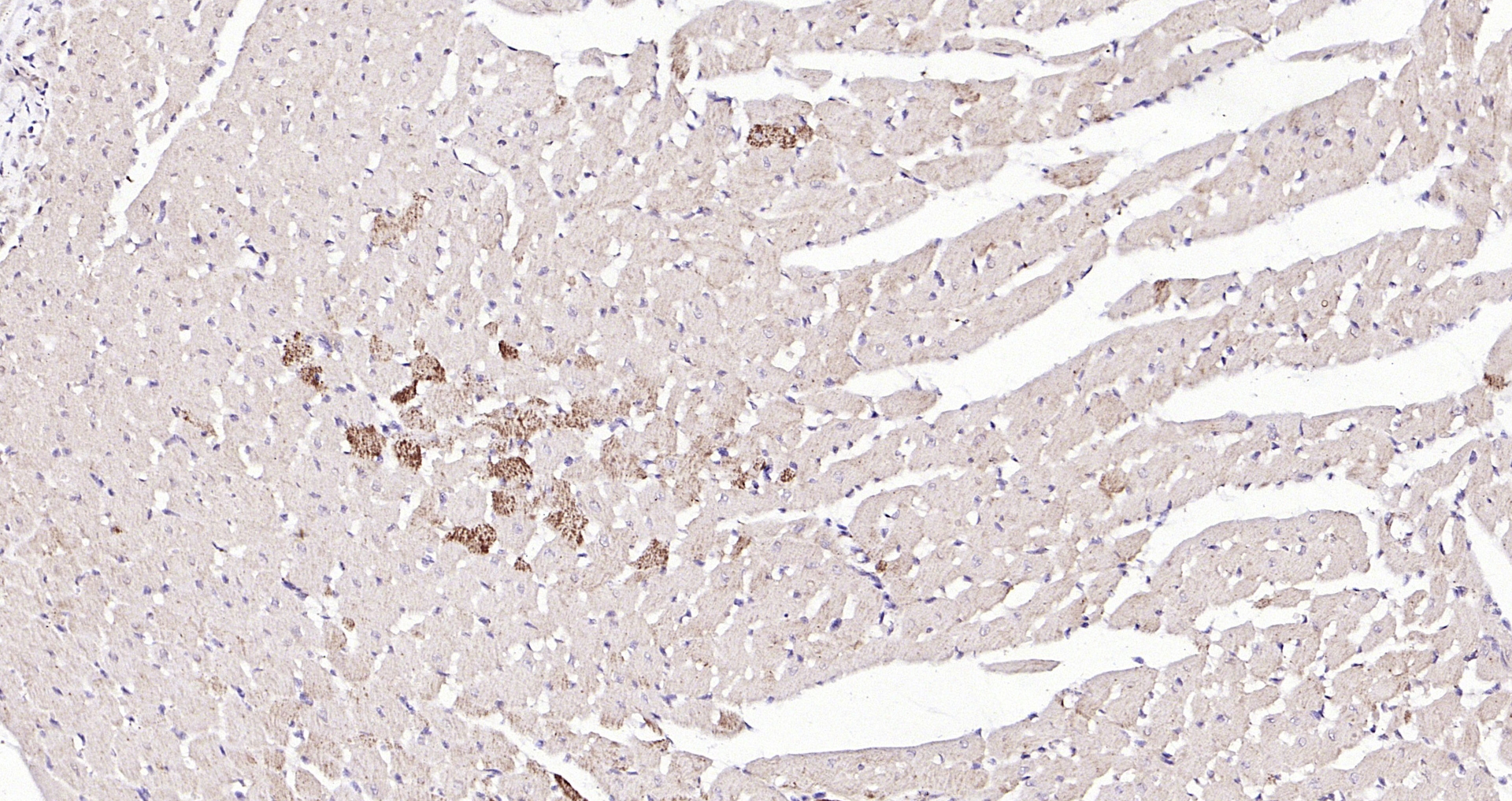 Paraformaldehyde-fixed, paraffin embedded (rat heart); Antigen retrieval by boiling in sodium citrate buffer (pH6.0) for 15min; Block endogenous peroxidase by 3% hydrogen peroxide for 20 minutes; Blocking buffer (normal goat serum) at 37°C for 30min; Antibody incubation with (phospho-ASK1 (Ser966)) Polyclonal Antibody, Unconjugated (bs-3007R) at 1:200 overnight at 4°C, followed by operating according to SP Kit(Rabbit) (sp-0023) instructionsand DAB staining.