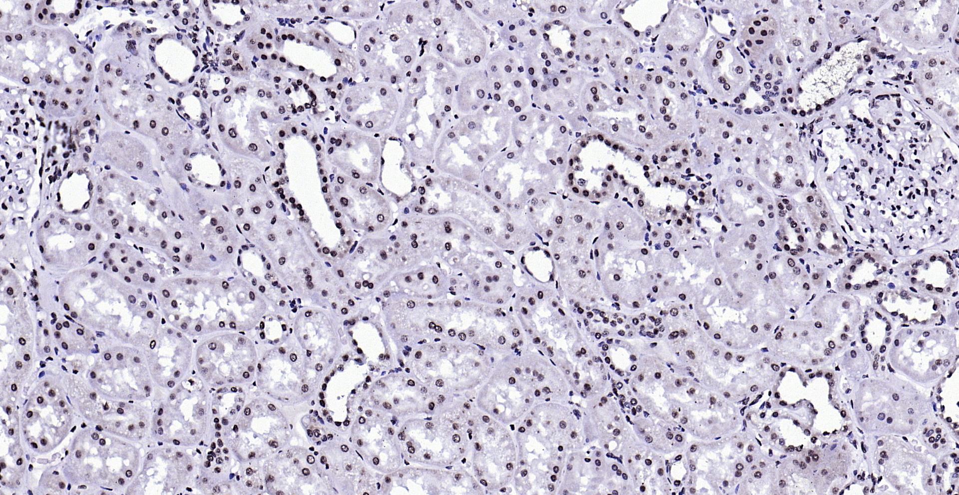 Paraformaldehyde-fixed, paraffin embedded (Human kidney); Antigen retrieval by boiling in sodium citrate buffer (pH6.0) for 15min; Block endogenous peroxidase by 3% hydrogen peroxide for 20 minutes; Blocking buffer (normal goat serum) at 37°C for 30min; Antibody incubation with (Phospho-FGFR1 (Tyr307)) Polyclonal Antibody, Unconjugated (bs-5325R) at 1:200 overnight at 4°C, followed by operating according to SP Kit(Rabbit) (sp-0023) instructionsand DAB staining.