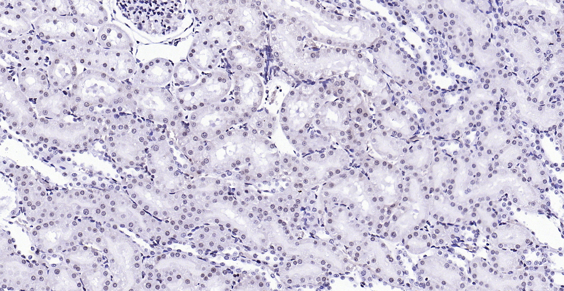 Paraformaldehyde-fixed, paraffin embedded (rat kidney); Antigen retrieval by boiling in sodium citrate buffer (pH6.0) for 15min; Block endogenous peroxidase by 3% hydrogen peroxide for 20 minutes; Blocking buffer (normal goat serum) at 37°C for 30min; Antibody incubation with (Phospho-FGFR1 (Tyr307)) Polyclonal Antibody, Unconjugated (bs-5325R) at 1:200 overnight at 4°C, followed by operating according to SP Kit(Rabbit) (sp-0023) instructionsand DAB staining.