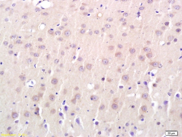 Formalin-fixed and paraffin embedded rat brain labeled with Anti-Connexin-32 Polyclonal Antibody, Unconjugated (bs-1376R) followed by conjugation to the secondary antibody and DAB staining