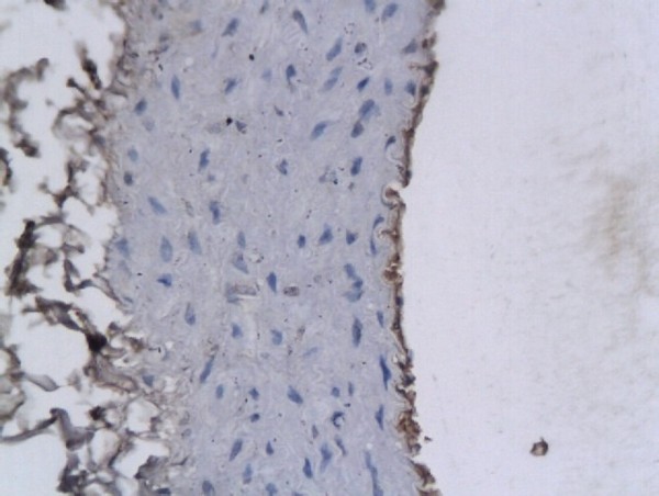 Formalin-fixed and paraffin embedded Rabbit Cartoid labeled with Anti-PAFAH2/Lp-PLA2 Polyclonal Antibody, Unconjugated (bs-1451R) followed by conjugation to the secondary antibody and DAB staining