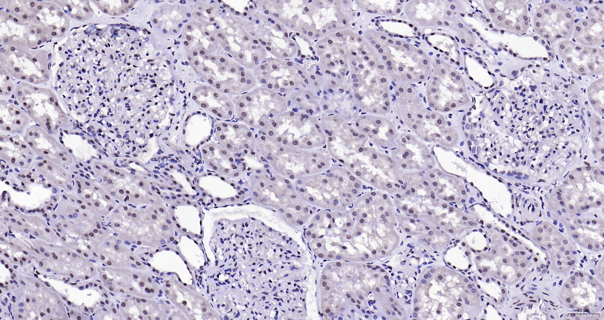 Paraformaldehyde-fixed, paraffin embedded (human kidney); Antigen retrieval by boiling in sodium citrate buffer (pH6.0) for 15min; Block endogenous peroxidase by 3% hydrogen peroxide for 20 minutes; Blocking buffer (normal goat serum) at 37°C for 30min; Antibody incubation with (BPTF) Polyclonal Antibody, Unconjugated (bs-11641R) at 1:200 overnight at 4°C, followed by operating according to SP Kit(Rabbit) (sp-0023) instructionsand DAB staining.