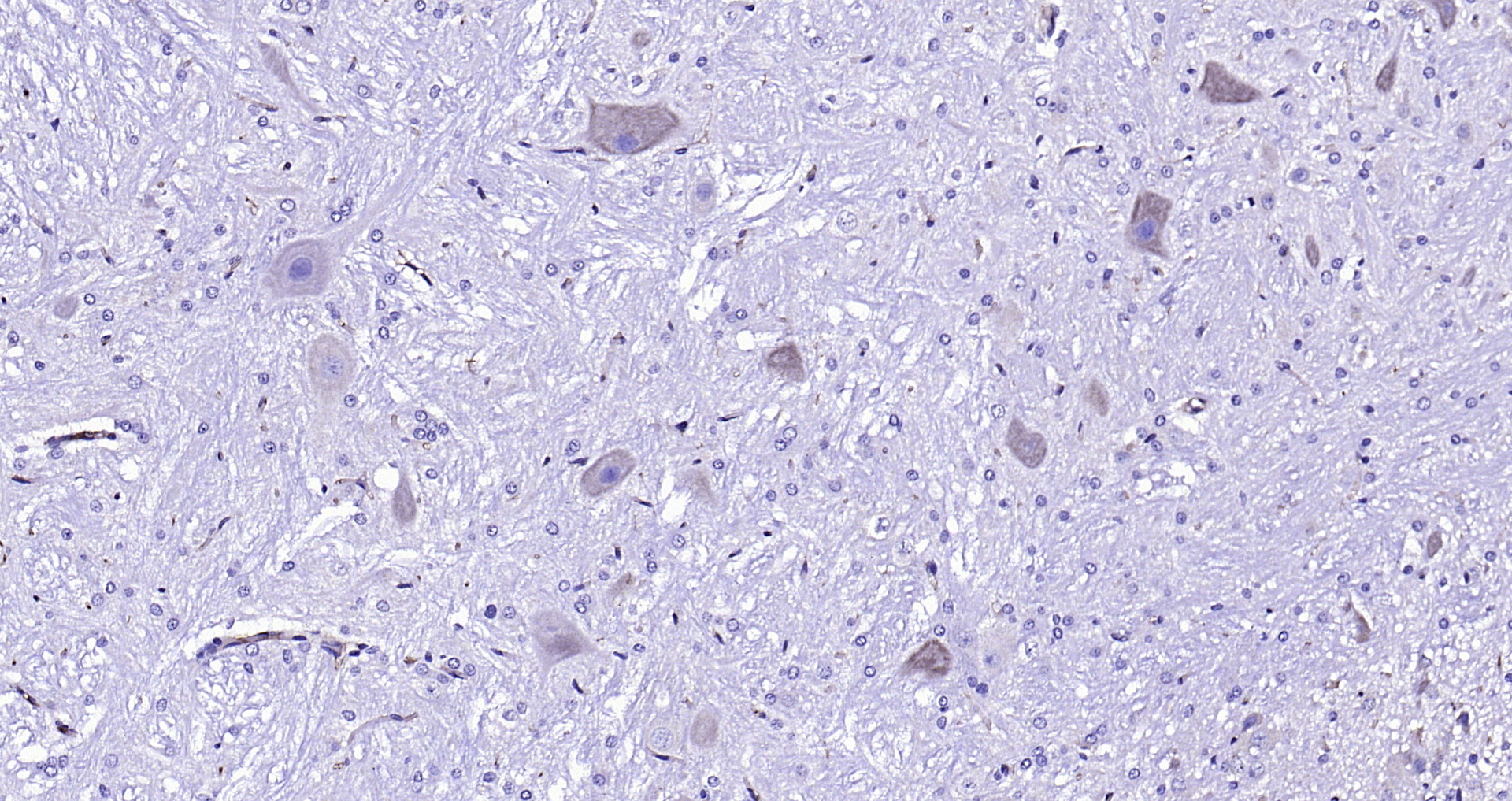 Paraformaldehyde-fixed, paraffin embedded (rat cerebellum); Antigen retrieval by boiling in sodium citrate buffer (pH6.0) for 15min; Block endogenous peroxidase by 3% hydrogen peroxide for 20 minutes; Blocking buffer (normal goat serum) at 37°C for 30min; Antibody incubation with (CLN8) Polyclonal Antibody, Unconjugated (bs-11715R) at 1:200 overnight at 4°C, followed by operating according to SP Kit(Rabbit) (sp-0023) instructionsand DAB staining.