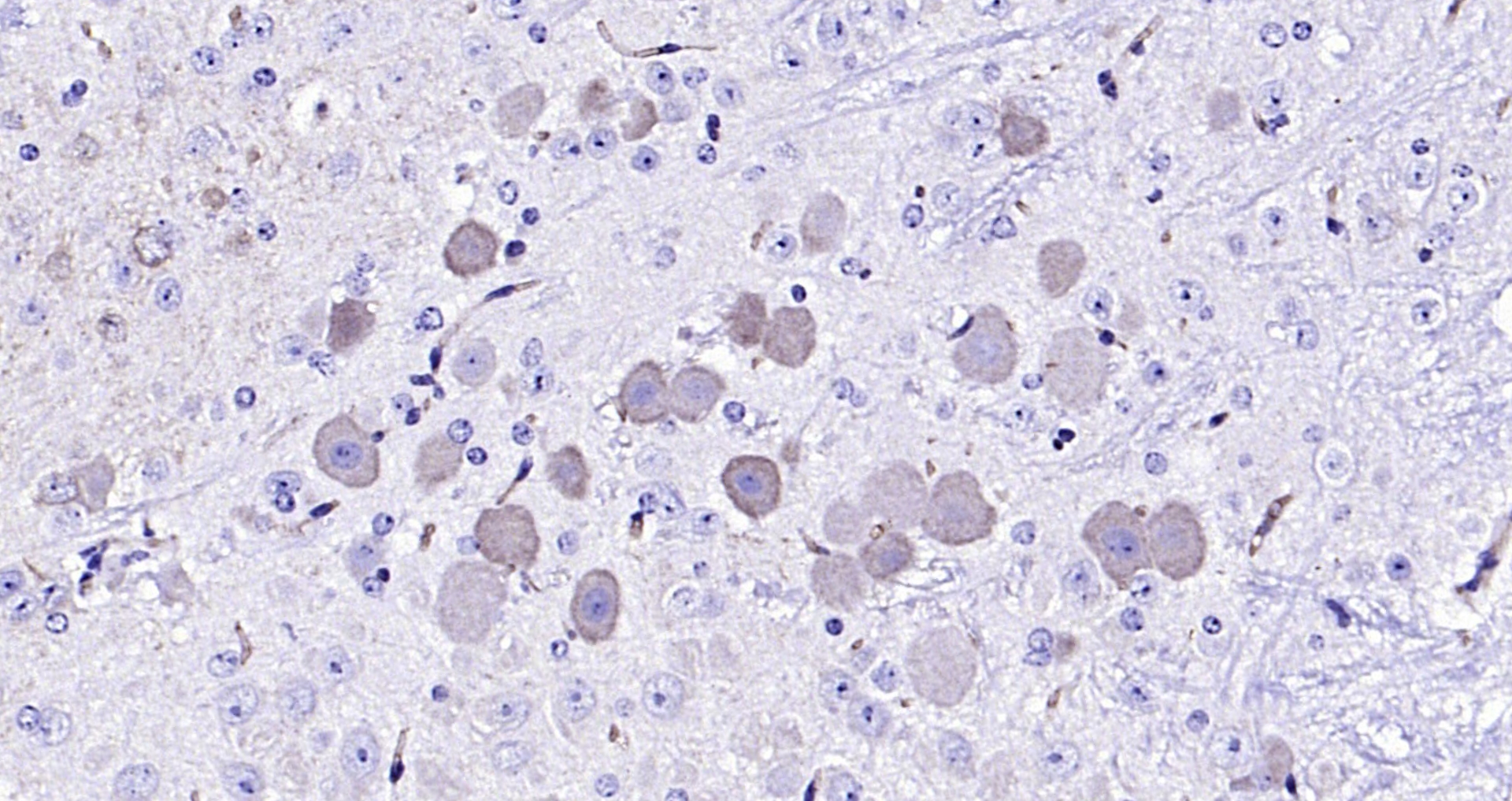 Paraformaldehyde-fixed, paraffin embedded (mouse cerebellum); Antigen retrieval by boiling in sodium citrate buffer (pH6.0) for 15min; Block endogenous peroxidase by 3% hydrogen peroxide for 20 minutes; Blocking buffer (normal goat serum) at 37°C for 30min; Antibody incubation with (CLN8) Polyclonal Antibody, Unconjugated (bs-11715R) at 1:200 overnight at 4°C, followed by operating according to SP Kit(Rabbit) (sp-0023) instructionsand DAB staining.